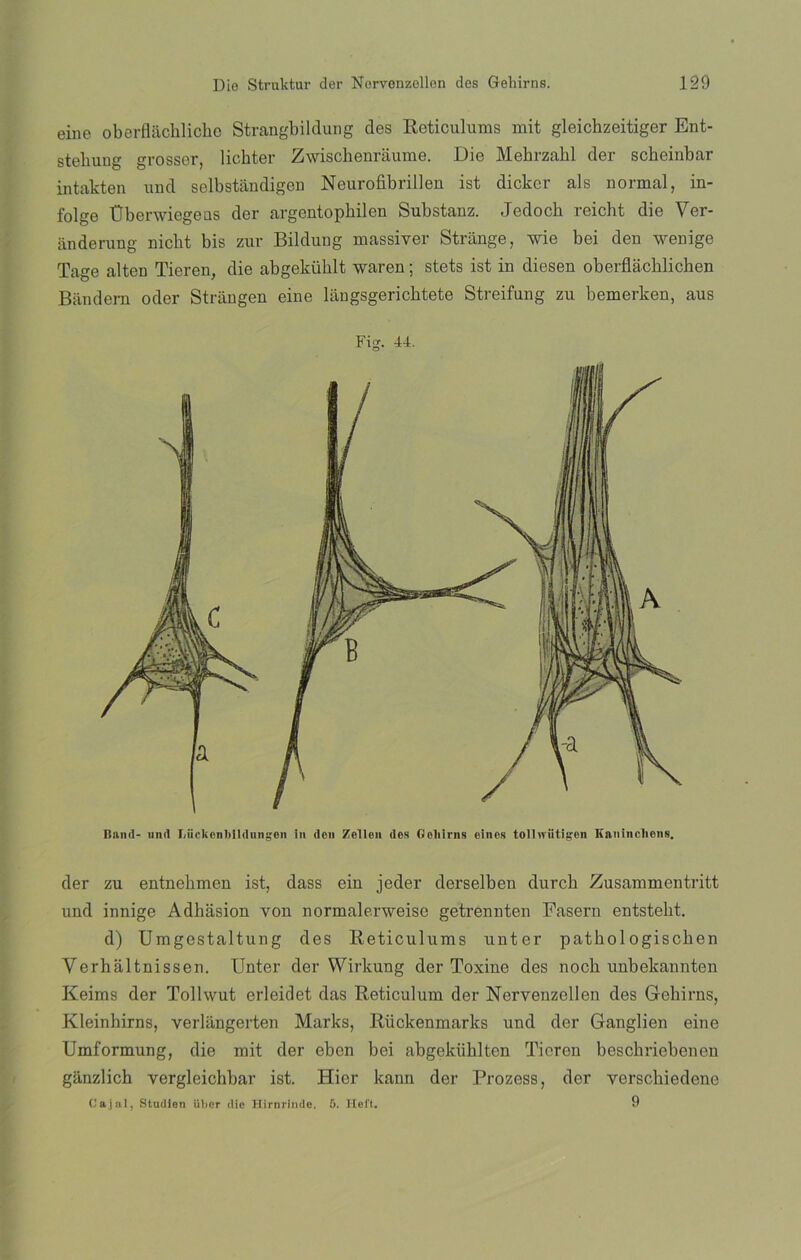 eine oberflaclilichc Strangbilclung des Reticulums mit gleichzeitiger Ent- stehung grossor, lichter Zwischenraume. Die Mehrzahl der scheinbar intakten und selbstandigen Neurofibrillen ist dicker ais normal, in- folge Überwiegeas der argentophilen Substanz. Jedoch reicht die Ver- án derung nicht bis zur Bildung massiver Stránge, wie bei den wenige Tage alten Tieren, die abgeküblt waren; stets ist in diesen oberflacblichen Bándern oder Strángen eine langsgericbtete Streifung zu bemerken, aus Band- und I/üclíonltildnngen in den Zellen des Goliirns eines toll wiitigen Kaninclions. der zu entnebmen ist, dass ein jeder derselben durck Zusammentritt und innige Adhiision von normalerweise getrennten Fasern entstebt. d) Umgestaltung des Reticulums unter patbologiscben Verhaltnissen. Unter der Wirkung der Toxine des noch unbekannten Keims der Tollwut erleidet das Reticulum der Nervenzollen des Gebirns, Kleinhirns, verlangerten Marks, Rückenmarks und der Ganglien eine Umformung, die mit der ebcn bei abgekiiklten Tioron besckriebenen ganzlich vergleichbar ist. Hier kann der Prozess, der verschiedene Cajal, Studien über die Hirnrimle. 5. Ileft. 9