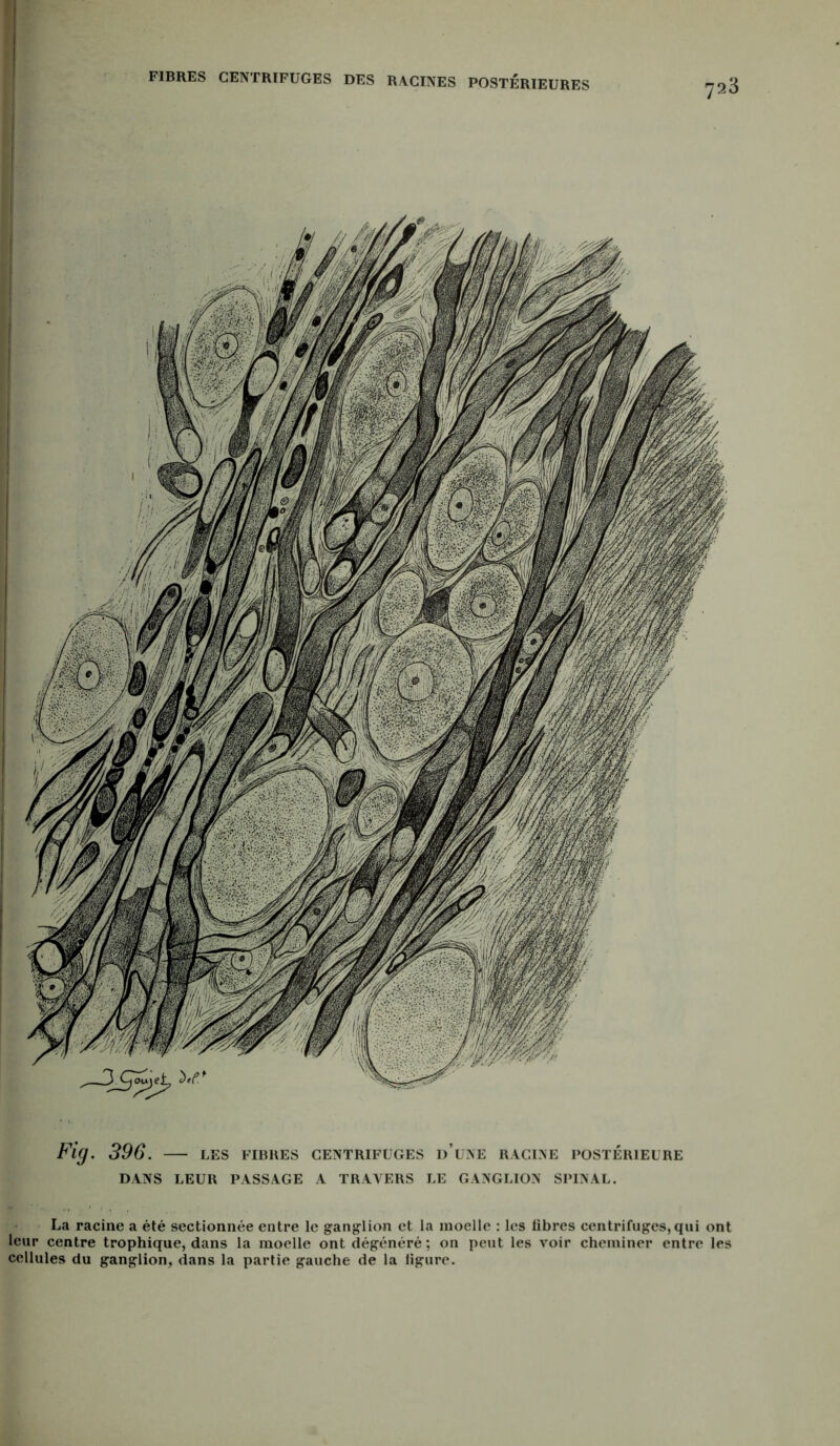 FIBRES CENTRIFUGES DES RACINES POSTÉRIEURES '23 Fig. 396. — les fibres centrifuges d’une racine postérieure DANS LEUR PASSAGE A TRAVERS LE GANGLION SPINAL. La racine a été sectionnée entre le ganglion et la moelle : les fibres centrifuges, qui ont leur centre trophique, dans la moelle ont dégénéré ; on peut les voir cheminer entre les cellules du ganglion, dans la partie gauche de la figure.