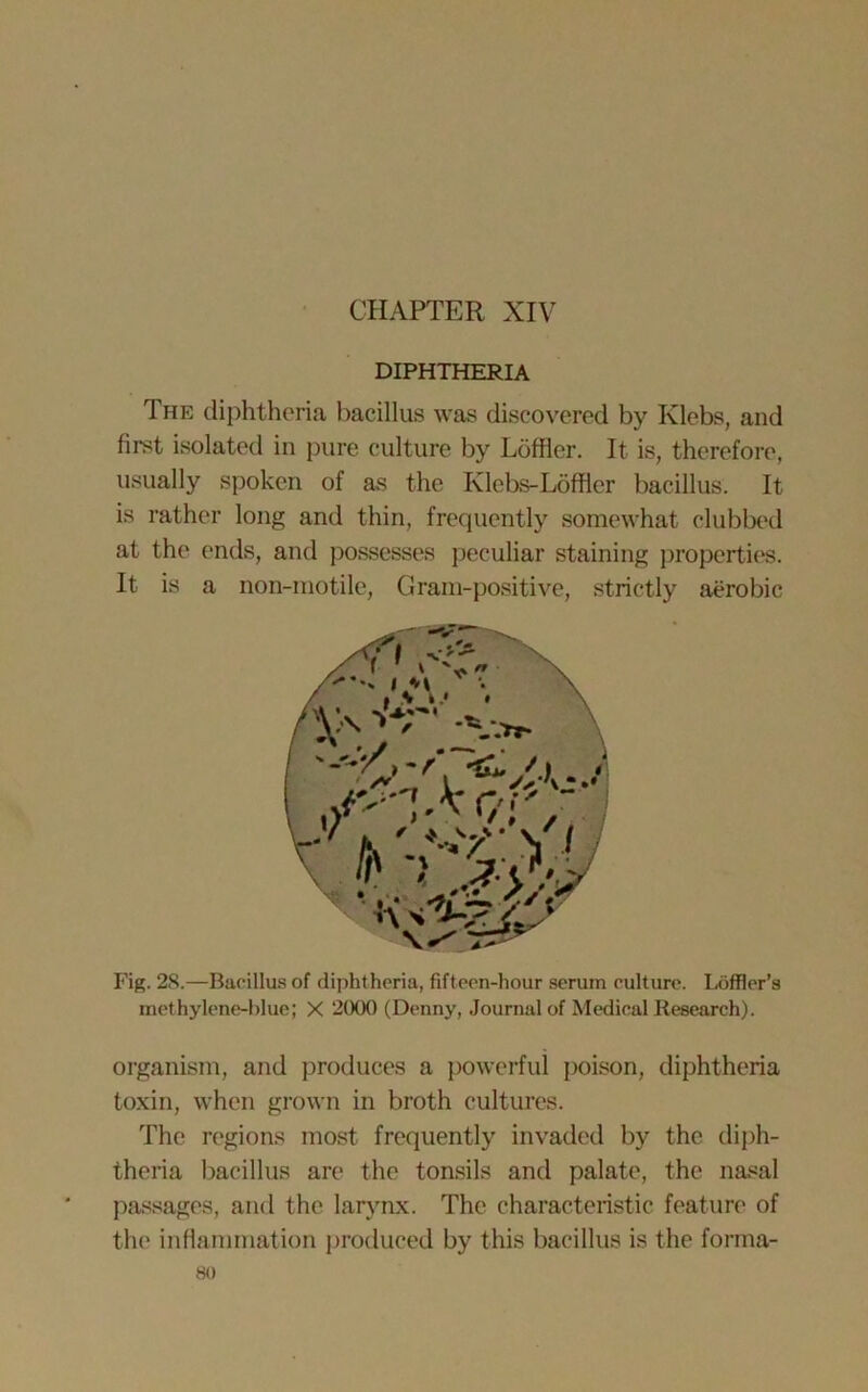 DIPHTHERIA The diphtheria bacillus was discovered by Klebs, and first isolated in pure culture by Loftier. It is, therefore, usually spoken of as the Klebs-Lofflcr bacillus. It is rather long and thin, frequently somewhat clubbed at the ends, and possesses peculiar staining properties. It is a non-motile, Gram-positive, strictly aerobic Fig. 28.—Bacillus of diphtheria, fifteen-hour serum culture. Loffler’s methylene-blue; X 2000 (Denny, Journal of Medical Research). organism, and produces a powerful poison, diphtheria toxin, when grown in broth cultures. The regions most frequently invaded by the diph- theria bacillus are the tonsils and palate, the nasal passages, and the larynx. The characteristic feature of the inflammation produced by this bacillus is the forma-