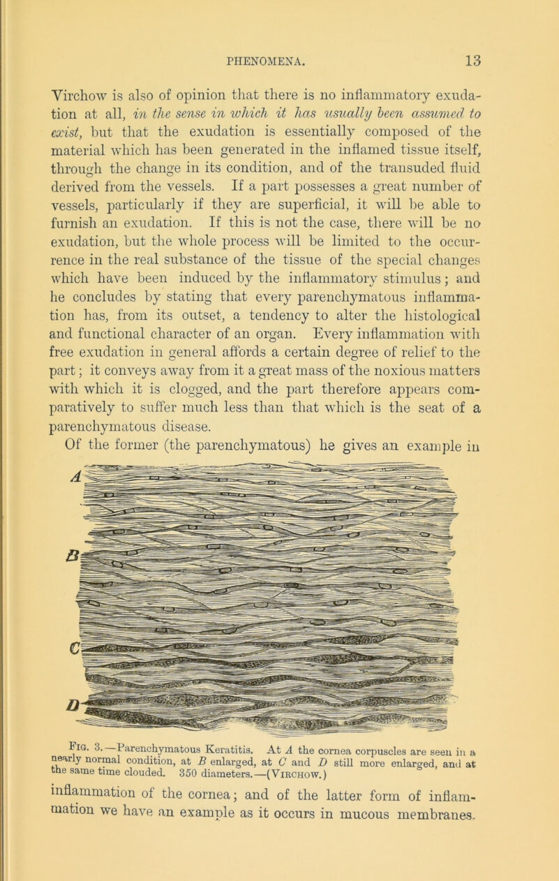 Virchow is also of opinion that there is no inflammatory exuda- tion at all, in the sense in which it has usually been assumed to exist, but that the exudation is essentially composed of the material which has been generated in the inflamed tissue itself, through the change in its condition, and of the transuded fluid derived from the vessels. If a part possesses a great number of vessels, particularly if they are superficial, it will be able to furnish an exudation. If this is not the case, there will be no exudation, but the whole process will be limited to the occur- rence in the real substance of the tissue of the special changes which have been induced by the inflammatory stimulus; and he concludes by stating that every parenchymatous inflamma- tion has, from its outset, a tendency to alter the histological and functional character of an organ. Every inflammation with free exudation in general affords a certain degree of relief to the part; it conveys away from it a great mass of the noxious matters with which it is clogged, and the part therefore appears com- paratively to suffer much less than that which is the seat of a parenchymatous disease. Of the former (the parenchymatous) he gives an example in Fig. 3. Parenchymatous Keratitis. At A the cornea corpuscles are seen in a near y normal condition, at B enlarged, at C and D still more enlarged, anti at the same time clouded. 350 diameters.—(Virchow.) inflammation of the cornea; and of the latter form of inflam- mation we have an example as it occurs in mucous membranes.