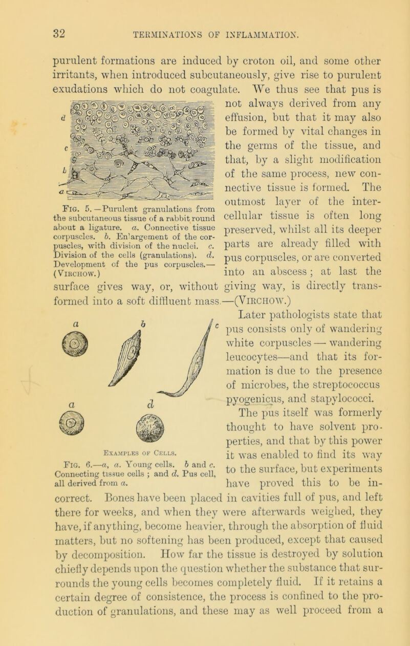 purulent formations are induced by croton oil, and some other irritants, when introduced subcutaneously, give rise to purulent exudations which do not coagulate. We thus see that pus is not always derived from any effusion, but that it may also be formed by vital changes in the germs of the tissue, and that, by a slight modification of the same process, new con- nective tissue is formed. The outmost layer of the inter- cellular tissue is often long preserved, whilst all its deeper parts are already filled with pus corpuscles, or are converted into an abscess ; at last the giving way, is directly trans- Fig. 5. —Purulent granulations from the subcutaneous tissue of a rabbit round about a ligature, a. Connective tissue corpuscles, b. En’argement of the cor- puscles, with division of the nuclei, c. Division of the cells (granulations), d. Development of the pus corpuscles.— (Virchow.) surface gives way, or, without formed into a soft diffluent mass.—(Virchow.) Later pathologists state that pus consists only of wandering white corpuscles — wandering leucocytes—and that its for- mation is due to the presence of microbes, the streptococcus pyogenicus, and stapylococci. The pus itself was formerly thought to have solvent pro- perties, and that by this power it was enabled to find its way to the surface, but experiments have proved this to be in- correct. Bones have been placed in cavities full of pus, and left there for weeks, and when they were afterwards weighed, they have, if anything, become heavier, through the absorption of fluid matters, but no softening has been produced, except that caused by decomposition. How far the tissue is destroyed by solution chiefly depends upon the question whether the substance that sur- rounds the young cells becomes completely fluid. If it retains a certain degree of consistence, the process is confined to the pro- duction of granulations, and these may as well proceed from a Examples of Cells. Fig. 6.—a, a. Young cells, b and c. Connecting tissue cells ; and d. Pus cell, all derived from a.