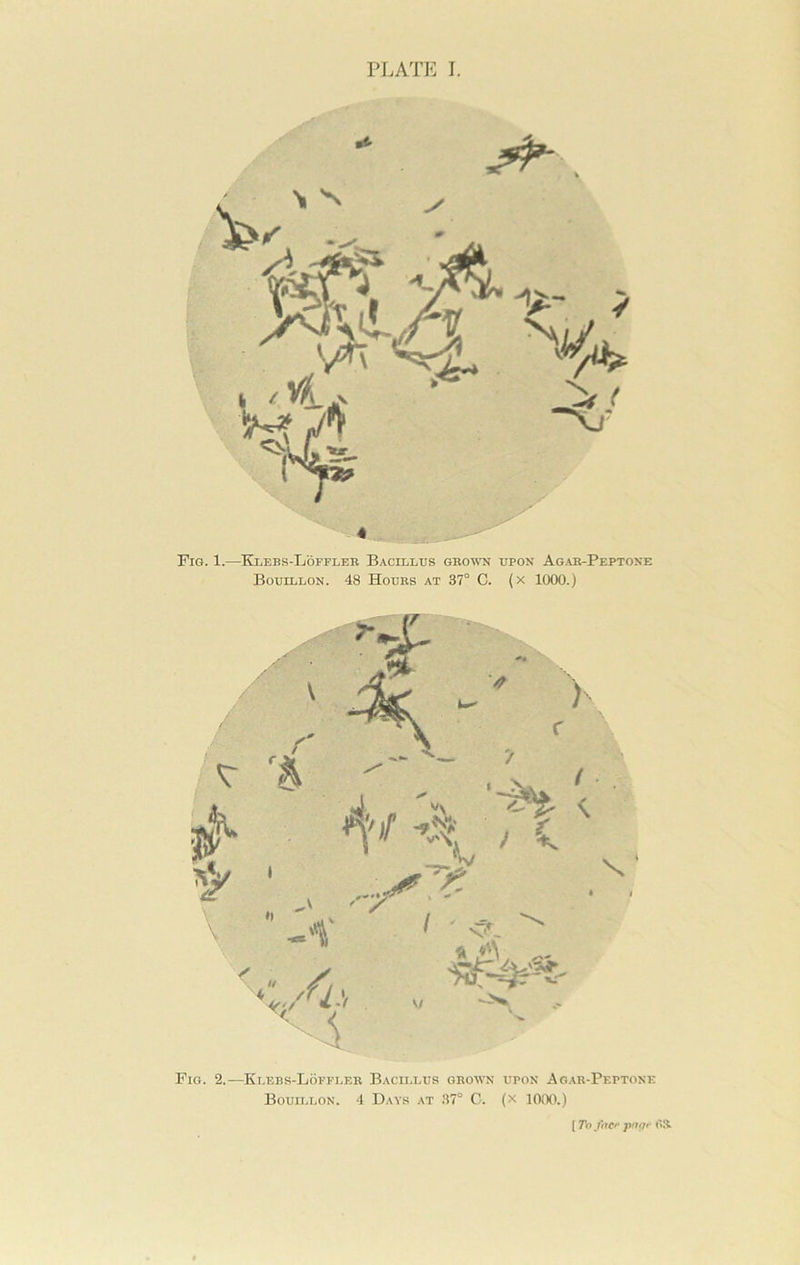 Fig. 1.—Klebs-Loffleb Bacillus gbowti upon Agab-Peptone Bouillon. 48 Houbs at 37° C. (x 1000.) Fig. 2.—Klebs-Loffleb Bacillus gbown upon Ag.\b-Peptone Bouillon. 4 Days at 37° C. (x 1000.) [ To fncf pnof'