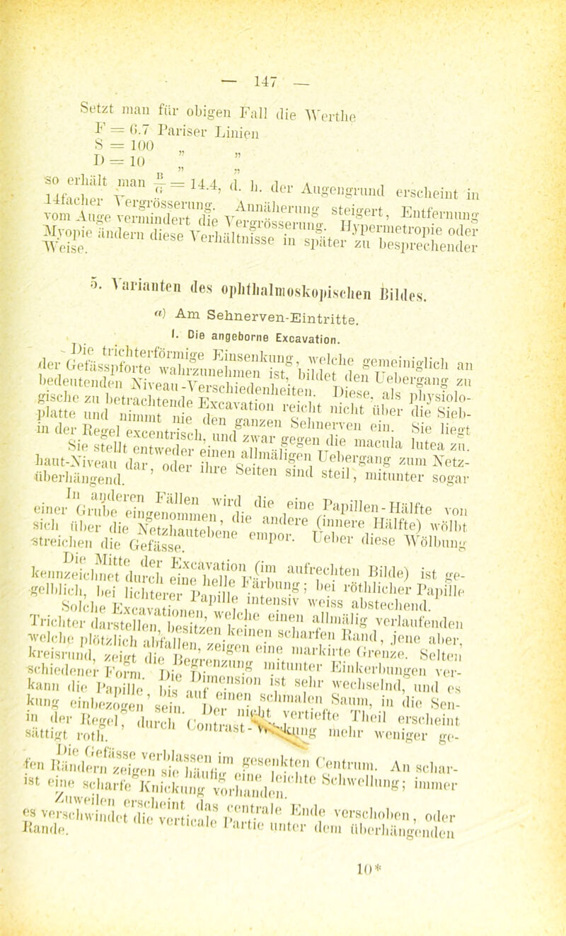 Setzt man für obigen Fall die Werthe F = G.7 Pariser Linien S = 100 d=io ;; y‘a ¥-t4* ■ h- *» *W«I erscheint in Ä'ÄSTfc ÄÄ sHg'rt’ Etfmms Xvopie iiiiclei'i] diese VerhältnWin s„«er Tb^Sendei' ^ arianten des ophthalmoskopischen Bildes. “) Am Sehnerven-Eintritte. I. Die angeborne Excavation. “ *%**» «centrisch, füte *** iiberhängend. ’ Suten sind steil, mitunter sogar einer^1Gnd! e' d n <renommen'die ^ 1° jeine fW11™-■Hälfte von sich über die SSne c an(lere (innere Hälfte) wölbt •streichen die Gefiisse. 1111101 • lieber diese Wölbung kennzefcÄdurch einf 1^0°aufrecllte]1 Bilde) ist ge- lblich, he ÄSi?Mg; bei r°Bilicher Papille Trichter darstellen^besitzenl et, “T ^77 Ständen welche plötzlich Kreisrund ypiirt p ’ ° l,in? nuiinite (rrenze. Seitei 1 schiedener Form Die j?'-<nzun.ß n.l'tunter Einkerbungen ver- kam. die PapflJe S,%nf f S?lir wechselnd,8und es kung einbezogen' sein ' Da! “fn,Saum» iu ,lie Sen- in der RegeirtocT*Con2,i ^LV6rt,eft? rheil erscheint sättigt roth. oiitiast-TV^dyrng mehr weniger ge- fen S^^S?Sre^8Tktfn CentrUin- Al1 «cl-ar. ,St einuew8?;iarfe. Knickung vorhanden.' lt0 &ehwellun»; »'»»ner «• vmd.winde! 'S virtÄ lAniea vecllob«n. oder Bande. ‘ *• hntci dem überhängenden 10*