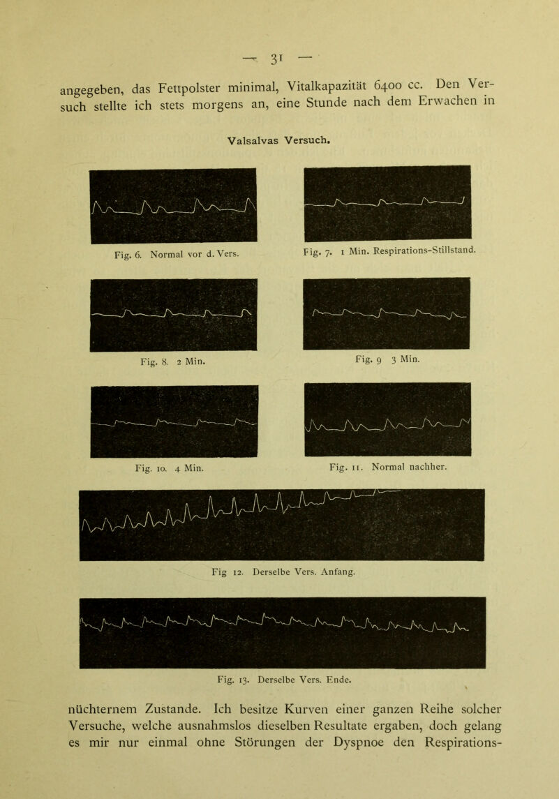 — 3^ angegeben, das Fettpolster minimal, Vitalkapazität 6400 cc. Den Ver- such stellte ich stets morgens an, eine Stunde nach dem Erwachen in Valsalvas Versuch. Fig. 6. Normal vor d. Vers. Fig. 8. 2 Min. Fig. 10. 4 Min. Fig. 9 3 Min. Fig. 11. Normal nachher. Fig 12. Derselbe Vers. Anfang. nüchternem Zustande. Ich besitze Kurven einer ganzen Reihe solcher Versuche, welche ausnahmslos dieselben Resultate ergaben, doch gelang es mir nur einmal ohne Störungen der Dyspnoe den Respirations-