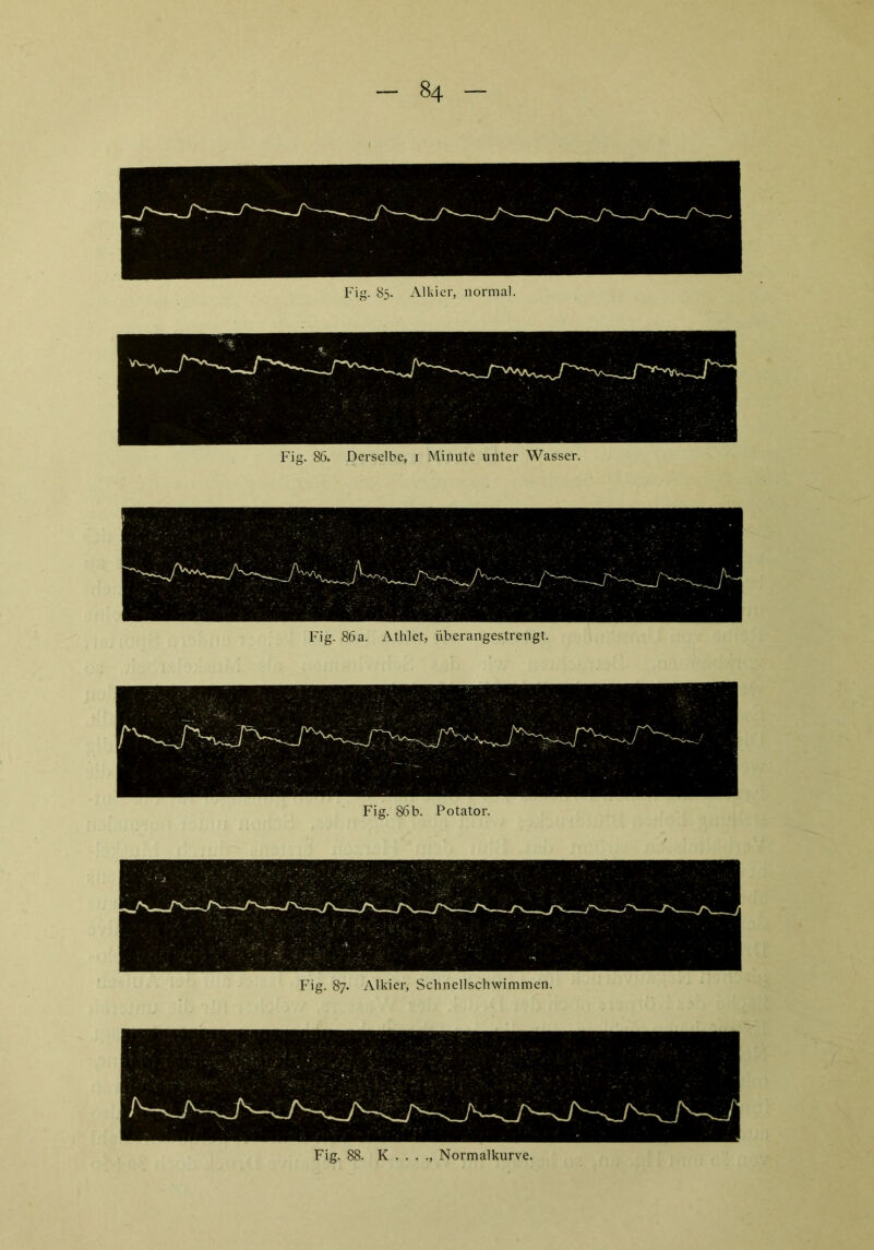 Fig. 85. Alkier, normal. Fig. 86. Derselbe, 1 Minute unter Wasser. Fig. 86a. Athlet, überangestrengt. Fig. 86b. Potator. Fig. 87. Alkier, Schnellschwimmen. Fig. 88. K . . . ., Normalkurve.