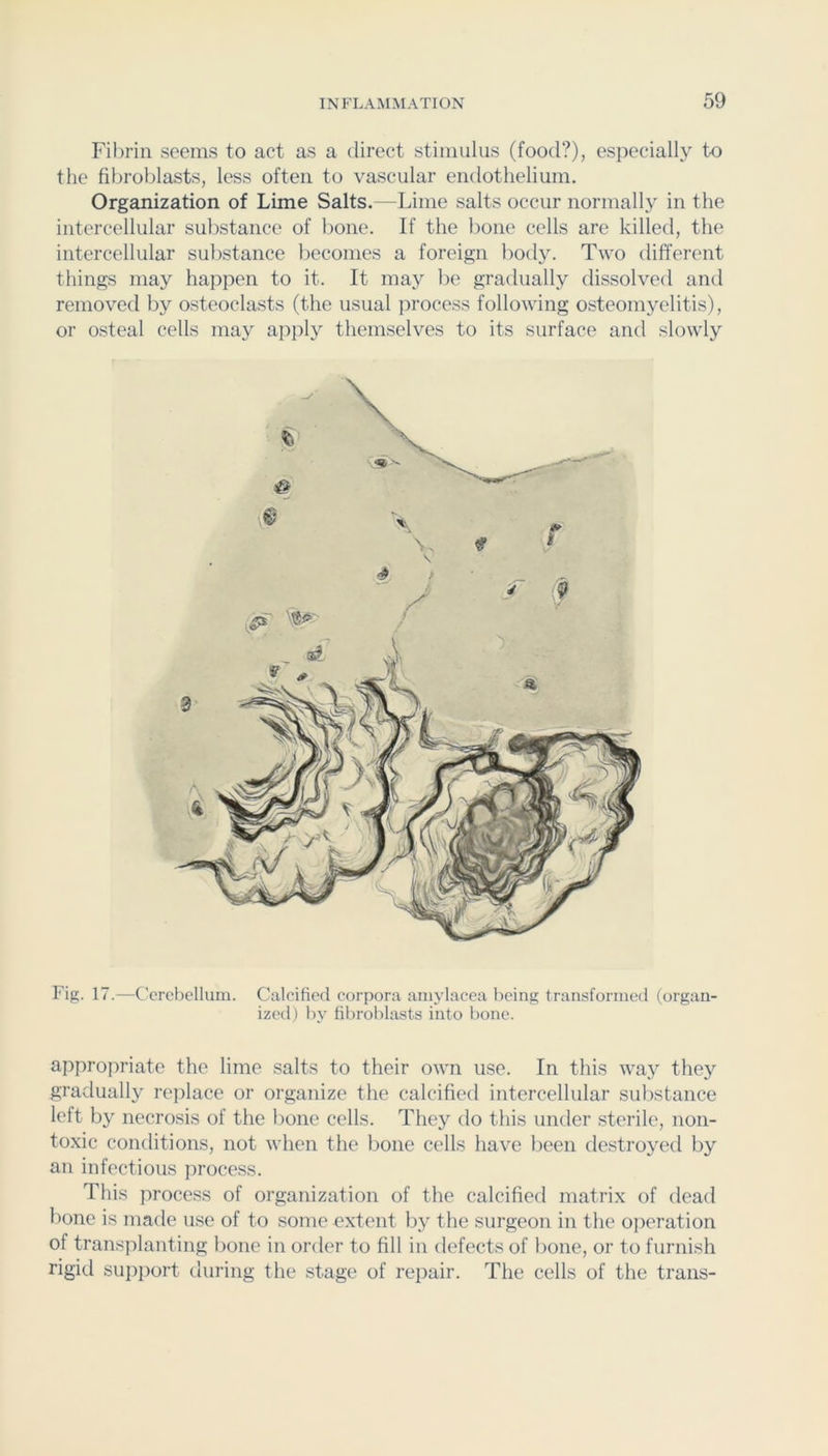 Fibrin seems to act as a direct stimulus (food?), especially to the fibroblasts, less often to vascular endothelium. Organization of Lime Salts.—Lime salts occur normally in the intercellular substance of bone. If the bone cells are killed, the intercellular substance becomes a foreign body. Two different things may happen to it. It may be gradually dissolved and removed by osteoclasts (the usual process following osteomyelitis), or osteal cells may apply themselves to its surface and slowly Fig. 17.—Ccrcl)ellum. Calcified corpora amjdacea being transformed (organ- ized) l)v fibroblasts into bone. appropriate the lime salts to their own use. In this way they gradually rejilace or organize the calcifietl intercellular substance left by necrosis of the bone cells. They do this under sterile, non- toxic contlitions, not when the bone cells have been destroyed by an infectious process. This process of organization of the calcified matrix of dead bone is made use of to some extent by the surgeon in the operation of transplanting bone in order to fill in defects of bone, or to furnish rigid sup])ort during the stage of repair. The cells of the trans-