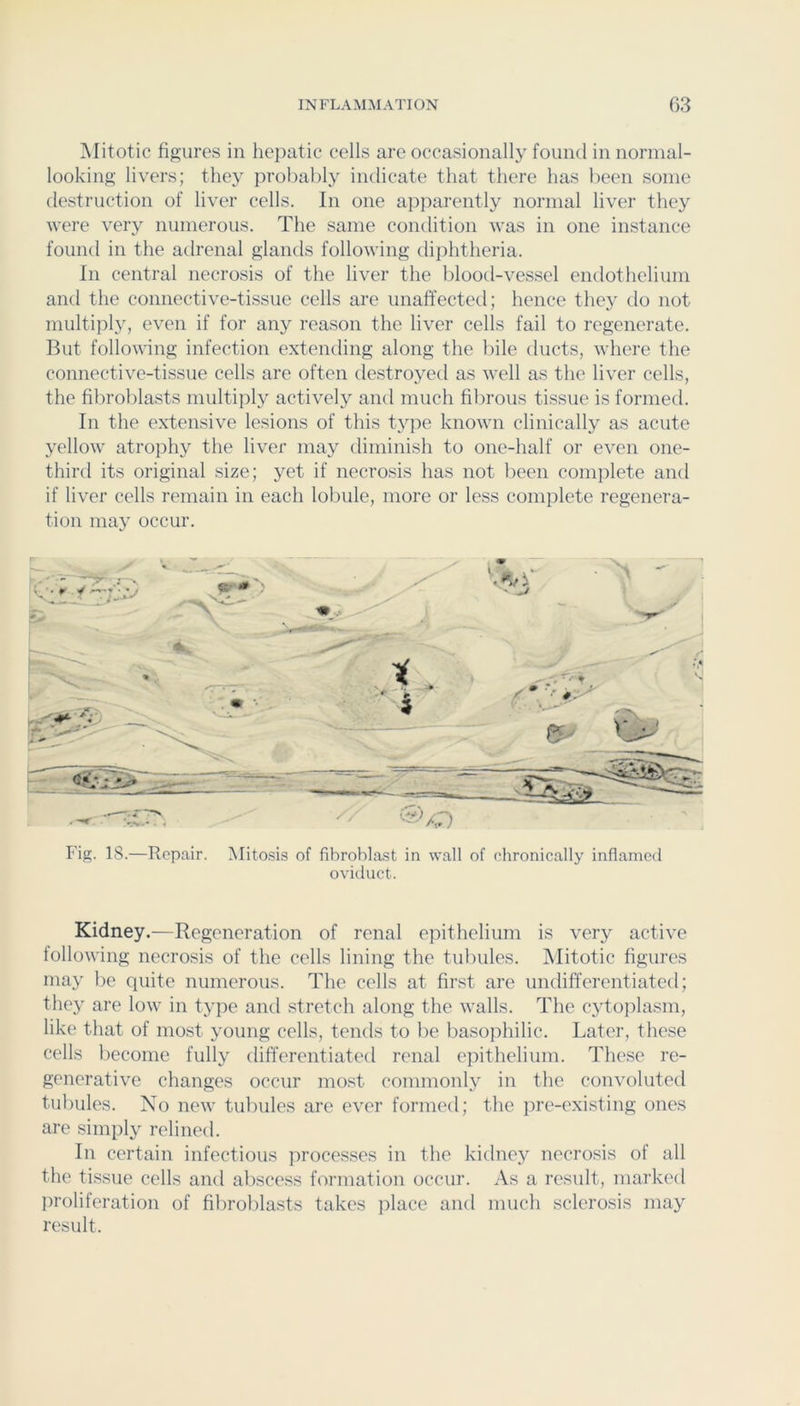 Mitotic figures in hepatic cells are occasionally found in normal- looking livers; they probably indicate that there has been some destruction of liver cells. In one a])parently normal liver they were very numerous. The same condition was in one instance found in the adrenal glands following diphtheria. In central necrosis of the liver the blood-vessel endothelium and the connective-tissue cells are unaffected; hence they do not multiply, even if for any reason the liver cells fail to regenerate. But following infection extending along the bile ducts, where the connective-tissue cells are often destroyed as well as the liver cells, the fibroblasts multiply actively and much fibrous tissue is formetl. In the extensive lesions of this type known clinically as acute yellow atrophy the liver may diminish to one-half or even one- third its original size; yet if necrosis has not been complete and if liver cells remain in each lobule, more or less complete regenera- tion may occur. Fig. 18.—Repair. Mitosis of fibroblast in wall of chronically inflamed oviduct. Kidney.—Regeneration of renal epithelium is very active following necrosis of the cells lining the tubules. Mitotic figures may be quite numerous. The cells at first are undifferentiated; they are low in type and stretch along the walls. The c3doiilasm, like that of most young cells, tends to be basophilic. Later, these cells become fully differentiated renal epithelium. These re- generative changes occur most commonly in the convoluted tubules. No new tubules are ever formed; the pre-existing ones are simply relined. In certain infectious ]irocesses in the kidney necrosis of all the tissue cells and abscess formation occur. As a result, marked jiroliferation of fibrolilasts takes place and much sclerosis may result.