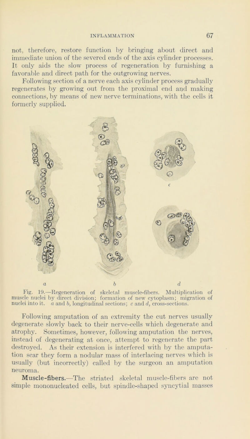 not, therefore, restore function l)y bringing about direct and iinniediate union of the severed ends of the axis cylinder processes. It only aids the slow process of regeneration by furnishing a favorable and direct path for the outgrowing nerves. Following section of a nerve each axis cylinder process gradually regenerates by growing out from the proximal end and making connections, by means of new nerve terminations, with the cells it formerly supplied. a b d Fig. 19.—Regeneration of skeletal muscle-fibers. Multijilication of muscle nuclei by direct division; formation of new cytophism; migration of nuclei into it. a and b, longitudinal sections; c and d, cross-sections. Following amputation of an extremity the cut nerves usually degenerate slowly back to their nerve-cells which degenerate and atrophy. Sometimes, however, following amputation the nerves, instead of degenerating at once, attempt to regenerate the part tlestroyed. As their extension is interfered with l)y the amjmta- tion scar they form a nodular mass of interlacing nerves which is usually (but incorrectly) called by the surgeon an amputation neuroma. Muscle-fibers.—The .striated .skeletal muscle-fibers are not simple mononucleated cells, but spindle-shaped syncytial masses