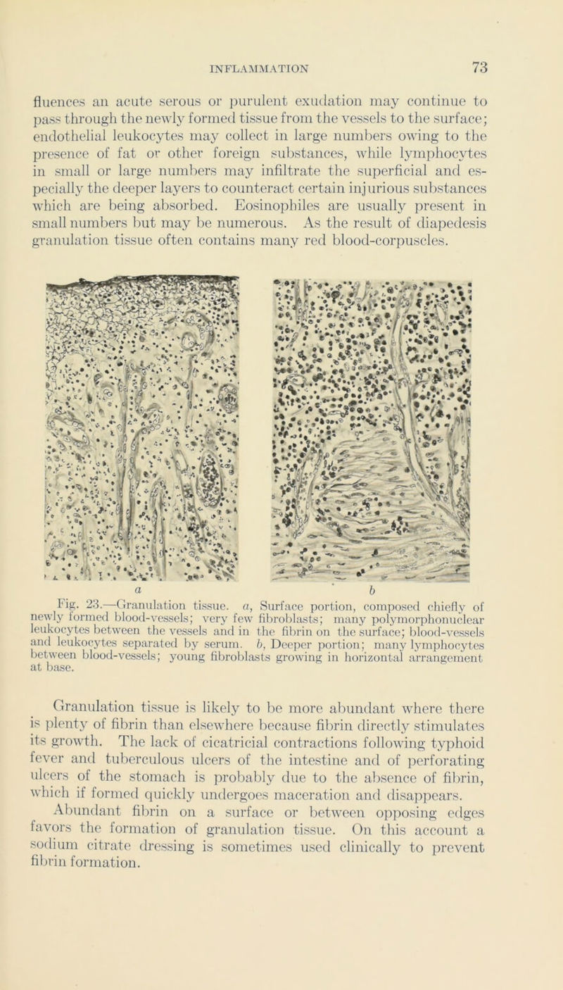 Alienees an acute serous or purulent exudation may continue to pass through the newly formed tissue from the vessels to the surface; endothelial leukocytes may collect in large numbers owing to the presence of fat or other foreign substances, while lymphocytes in small or large numbers may iiiAltrate the superAcial and es- pecially the deeper layers to counteract certain injurious substances which are being absorbed. Eosinophiles are usually present in small numbers but may lie numerous. As the result of diapedesis granulation tissue often contains many reil blood-corpuscles. tig. 23.—Granulation ti.ssuc. a, Surface portion, composed chiefly of newly formed blood-vessets; very few filirobhxsts; many polymorphonuclear leukocytes between the vessels and in the fibrin on the surface; blood-vesseb and leukocytes sepai-ated by serum. 6, Deeper portion; many lymphocyte!- between blood-vessels; young fibroblasts growing in horizontal aiTangement at ba.se. Granulation tissue is likely to be more abundant ivhere there is plenty of Abrin than elsewhere because Abrin directly stimulates its groivth. The lack of cicatricial contractions following typhoid fever and tulierculous ulcers of the intestine and of iierforating ulcers of the stomach is probably due to the absence of Abrin, which if formed cpnckly undergoes maceration and disappears. Abundant Abrin on a surface or between opposing edges favors the formation of granulation tissue. On this account a sodium citrate dressing is .sometimes used clinically to prevent Abrin formation.