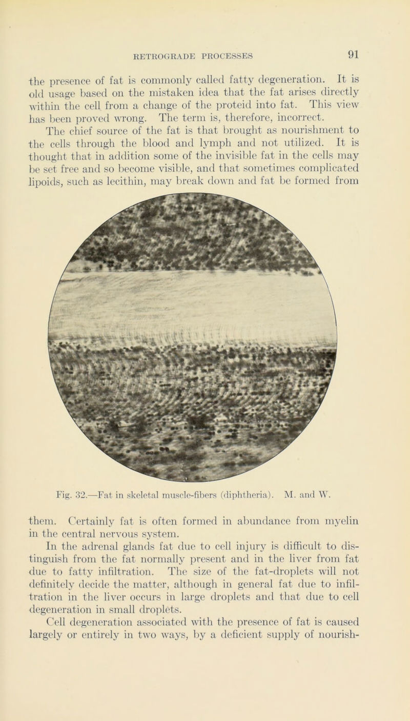 the presence of fat is commonly called fatty degeneration. It is old usage leased on the mistaken idea that the fat arises directly within the cell from a change of the ])roteid into fat. This view has been jn-oved wrong. The term is, therefore, incorrect. The chief source of the fat is that brought as nourishment to the cells through the blood and lymph and not utilized. It is thought that in addition some of the invisil)le fat in the cells may be set free and so become visible, and that sometimes com])licated lipoids, such as lecithin, may break down and fat be formed from Fig. 32.—Fat in skeletal masele-fibers (diphtheria). AF and W. them. Certainly fat is often formed in abundance from myelin in the central nervous system. In the adrenal glands fat due to cell injury is difficult to dis- tinguish from the fat normally jiresent and in the liver from fat due to fatty infiltration. The size of the fat-droplets will not definitely decide the matter, although in general fat due to infil- tration in the liver occurs in large droplets and that due to cell tlegeneration in small droplets. Cell degeneration associated with the presence of fat is caused largely or entirely in two ways, by a deficient supply of nourish-