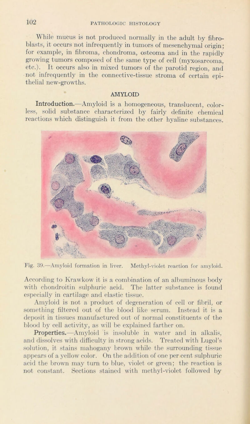 ^^'hile mucus is not i)roduced iiornially in the adult by filiro- blasts, it occurs not infrequently in tumors of mesenchymal origin; for example, in fibroma, chomlroma, osteoma and in the rapidly growing tumors composed of the same type of cell (myxosarcoma, etc.). It occurs also in mixed tumors of the parotid region, ami not infrequently in the connective-tissue stroma of certain ej)i- thelial new-growths. AMYLOID Introduction.—Amyloid is a homogeneous, translucent, color- less, solid substance characterized by fairly definite chemical reactions which distinguish it from the other hyaline substances. I’ig. 39.—Amyloid formation in liver. Methyl-violet reaction for amyloid. According to Krawkow it is a combination of an albuminous body with chondroitin sul])huric acid. The latter substance is found especially in cartilage and elastic tissue. Amyloid is not a product of degeneration of cell or fibril, or something filtered out of the blood like serum. Instead it is a (lej)osit in tissues manufactured out of normal constituents of the blood by cell activity, as will be explained farther on. Properties.—Amyloid is insoluble in wati'r and in alkalis, and dissolves with difficulty in strong acids. Treated with Lugol’s solution, it stains mahogany brown while the surrounding tissue appears of a yellow color. On the addition of one p(T cent sulphuric acid the brown may turn to blue, violet or green; the reaction is not constant. Sections stained with methyl-violet followed by
