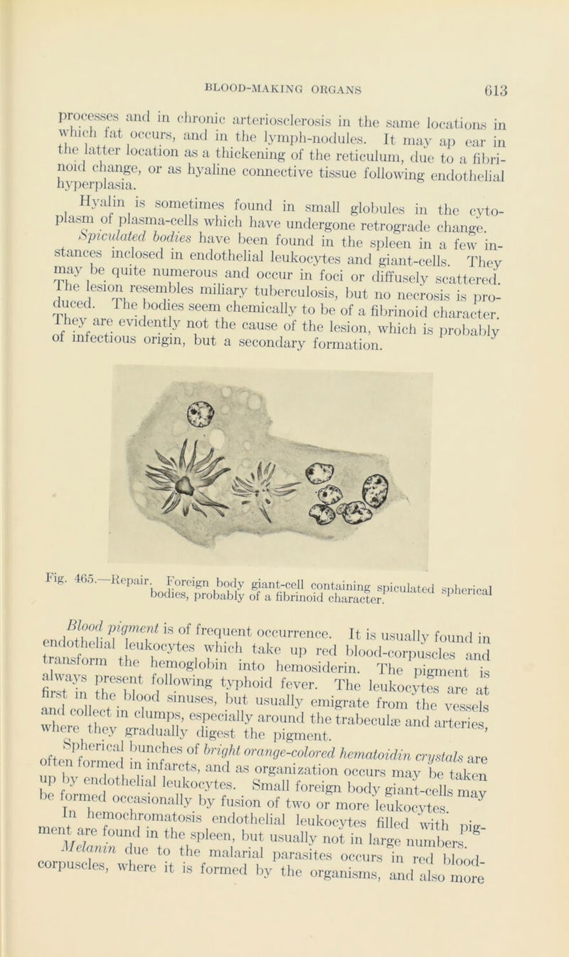 processes and in cliroine arteriosclerosis in the same locations in which fat occurs, and in the lymiih-nodules. It may ap ear in t le latter location as a thickening of the reticulum, due to a fibri- noid change, or as hyaline comiective tissue following endothelial liyj:)erplasia. Hyalin is sometimes found in small globules in the cyto- plasm of plasma-cells which have undergone retrograde change. Spiculated bodies have been found in the spleen in a few in- stances inclosed m endothelial leukocytes and giant-cells They may be quite numerous and occur in foci or diffusely scattered r , tuberculosis, l)ut no necrosis is ])ro- duced. 1 he bodies seem chemically to be of a fibrinoid character They are evidently not the cause of the lesion, which is probably of infectious origin, but a secondary formation. Fig. 46.5.—Kopair. Foreign body giant-cell boiisrw Blood pigment is of frequent occurrence. It is usually found in and aisform the hemoglobin into hemosiderin. The pigment is alvays present following typhoid fever. The leukocytes are at nnd c V ’^'t usually emigrate from‘the vessels c 1(1 collect in clumiis, especially around the trabecuhe and arteries where they gradually digest the jiigment. ’ ofton^fn^^'^'\^ luinches of bright orange-colored hematoidin crystals are nnTv ui m arcts, and as organization occurs may be taken lio f ^ leukocytes. Small foreign body giant-cells mav bo formed occasionally by fusion of two or more leukocytes mnnt endothelial leukocytes filled with piir It je found m the sjileen, but usually not in large numbers ^ ^Iclamn due to the malarial parasites occurs in red blood corpuscles, whore it is formed l,v the or^misms, lo mli