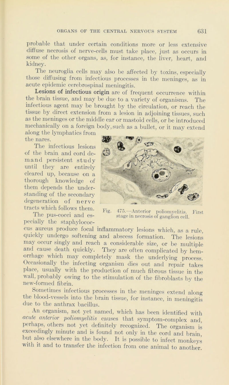 ]:)rohable that under certain conditions more or less extensive ditluse necrosis of nerve-cells must take ]:>lace, just as occurs in some of the other organs, as, for instance, the liver, heart, and kidne}'. The neuroglia cells may also be affected I)}' toxins, especially those diffusing from infectious processes in the meninges, as in acute epitlemic cerebrospinal meningitis. Lesions of infectious origin are of frequent occurrence within the brain tissue, and may be due to a variety of organisms. The infectious agent may be brought l)y the circulation, or reach the tissue by direct extension from a lesion in adjoining tissues, such as the meninges or the middle ear or mastoid cells, or be introduced mechanically on a foreign body, such as a bullet, or it may extend along the l3unphatics from the nares. The infectious lesions of the brain and cord de- mand persistent study until the^ are entirely cleared up, because on a thorough knowledge of them depends the under- standing of the secondary' degeneration of nerve tracts which follows them. The pus-cocci and es- pecially the staph,ylococ- Fig. 47.5.—Anterior polioinyoliti.s. First stage in necrosis of ganglion cell. cus aureus produce focal inflammatory lesions which, as a rule, quickly undergo softening and abscess formation. The lesions may occur singly and reach a considerable size, or be multiple and cau.se death quickly. They are often complicated by hem- orrhage which may completely mask the underlying ])rocess. Occasionally the infecting organism dies out and rt'jtair takes place, usually with the production of much filtrous tissue in the wall, itrobably owing to the stimulation of the fibroblasts by the new-formed filtrin. Sometimes infectious ]wocesses in the meninges extend along the blood-vessels into the brain tissue, for instance, in meningitis due to the anthrax bacillus. An organism, not yet named, which has been identified with acute anterior poliomyelitis causes that symptom-complex and, perhaps, others not j^et definitely recognized. The organism is exceedingly minute and is found not only in the cord and brain, but also elsewhere in the body. It is possible to infect monkeys with It and to transfer the infection from one animal to another.