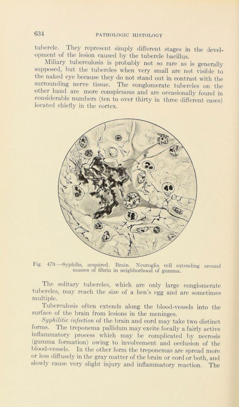 tul)crcle. They represent sinijily different stages in the devel- opment of tlie lesion caused by the tubercle bacillus. Miliary tuberculosis is probably not so rare as is generally supposed, but the tubercles when very small are not visible to the naked eye because they do not stand out in contrast with the surrounding nerve tissue. The conglomerate tubercles on the other hand are more conspicuous and are occasionally found in considerable numbers (ten to over thirty in three different cases) located chiefly in the cortex. I'ig. 479.—Sypliilis, accjiiirecl. Brain. Xeuroglia cell extending around masses of fibrin in neighborhood of gumma. The solitary tubercles, which are only large conglomerate tubercles, may reach the size of a hen’s egg and are sometimes multijile. ruberculosis often extends along the blood-vessels into the surface of the brain from lesions in the meninges. Syphilitic infection of the brain and cord may take two distinct forms. The treponema pallidum may excite focally a fairly active inflammatory process which may be complicated by necrosis (gumma formation) owing to involvement and occlusion of the blood-vessels. In the other form the treponemas are spread more or less rliffusely in the gray matter of the brain or cord or both, and slowly cause very slight injury and inflammatory reaction. The