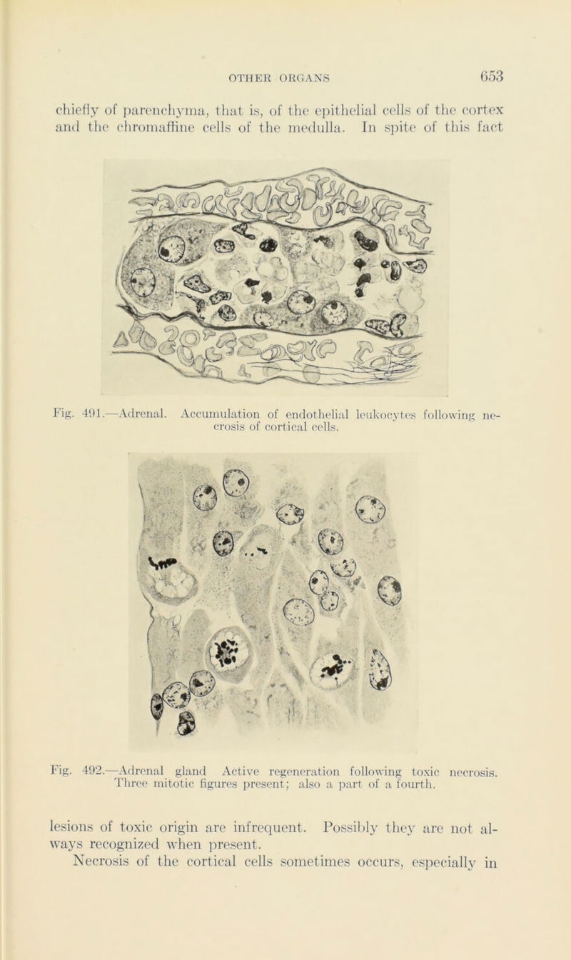 chiefly of parenchyma, tliat is, of the epithelial cells of the cortex ami the chromatfine cells of the nuHlulla. In s])ite of this fact FiS- 491.—Adrenal. Accumulation of endothelial leukocytes following ne- crosis of cortical colls. Fig. 492.—Adrenal gland Active regeneration following toxic necrosis. Three mitotic figures present; also a part of a fourth. lesions of toxic origin arc infrequent. Possihl}' they are not al- ways recognized when present. Necrosis of the cortical cells sometimes occurs, especiall,y in