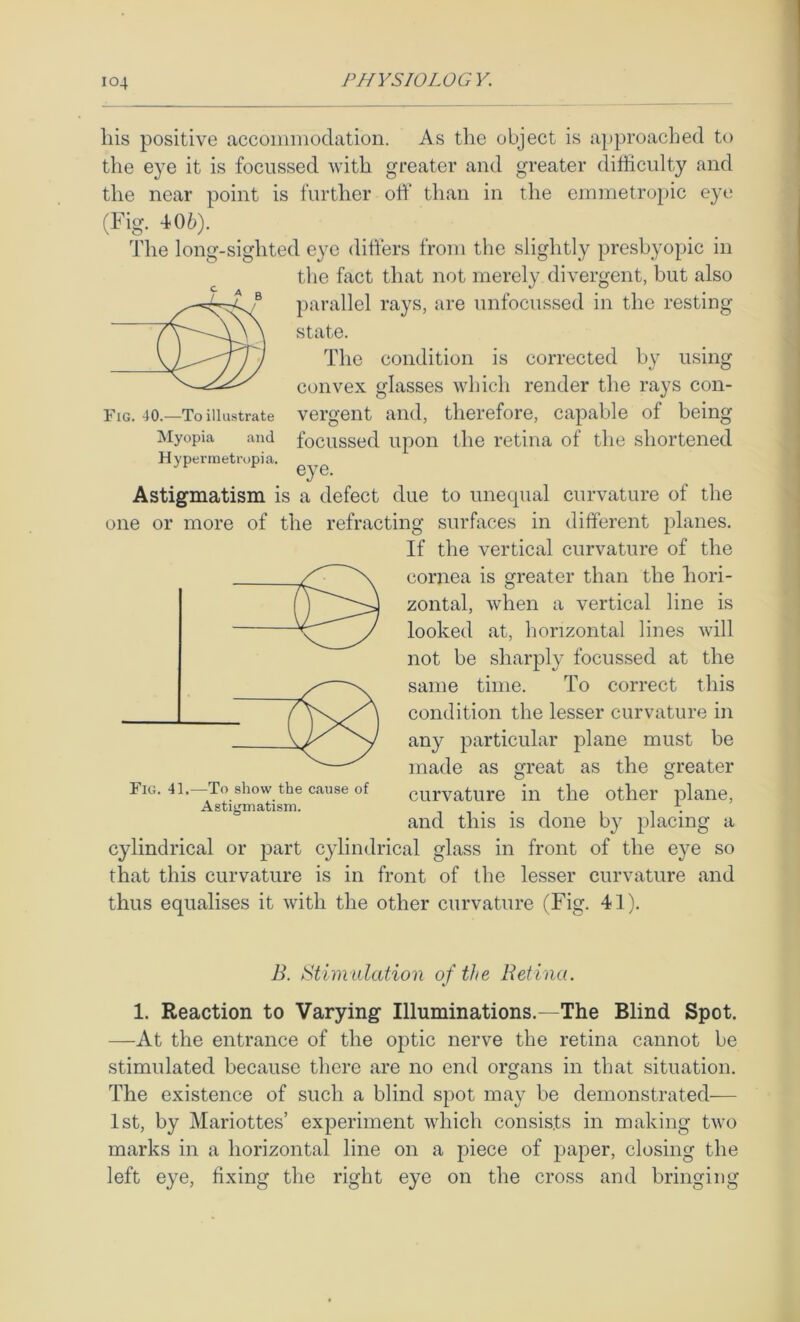 Fig. 40.—To illustrate ^Myopia and Hypermetropia, Ills positive accommodation. As the object is approaclied to the eye it is focussed with greater and greater ditficulty and the near point is further off than in the emmetropic eye (Fig. 406). The long-sighted eye ditfers from the slightly presbyopic in the fact that not merely divergent, but also parallel rays, are unfocussed in the resting state. The condition is corrected by using convex glasses which render the rays con- vergent and, therefore, capable of being focussed upon the retina of the shortened eye. Astigmatism is a defect due to unequal curvature of the one or more of the refracting surfaces in different planes. If the vertical curvature of the cornea is greater than the hori- zontal, when a vertical line is looked at, horizontal lines will not be sharply focussed at the same time. To correct this condition the lesser curvature in any particular plane must be made as great as the greater curvature in the other plane, and this is done by placing a cylindrical or part cylindrical glass in front of the eye so that this curvature is in front of the lesser curvature and thus equalises it with the other curvature (Fig. 41). Fig. 41.—To show the cause of Astigmatism. B. stimulation of the Retina, 1. Reaction to Varying Illuminations.—The Blind Spot. —At the entrance of the optic nerve the retina cannot be stimulated because there are no end organs in that situation. The existence of such a blind spot may be demonstrated— 1st, by Mariottes’ experiment which consists in making two marks in a horizontal line on a piece of paper, closing the left eye, fixing the right eye on the cross and bringing