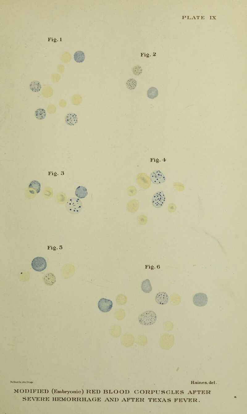 Fig.l Fig. 2 Fig. 4 Fig. 3 % # Fig. 5 Fig. 6 The OrcuN Co,Litho. Chicago. del . MODIFIED (Embryonic) RED BLOOD CORPUSCLES AFTER SEVERE HEMORRHAGE AND AFTER TEXAS FEVER.