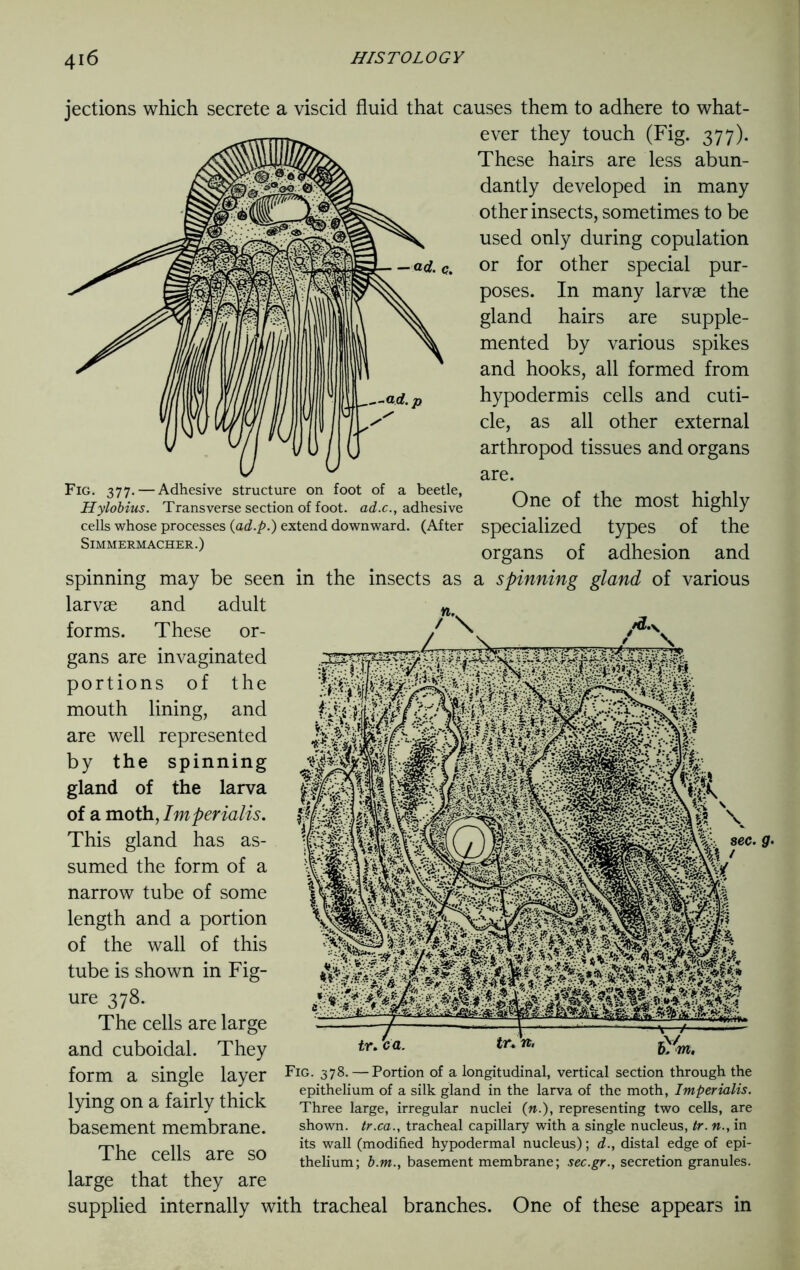 — ad. q. jections which secrete a viscid fluid that causes them to adhere to what- ever they touch (Fig. 377). These hairs are less abun- dantly developed in many other insects, sometimes to be used only during copulation or for other special pur- poses. In many larvae the gland hairs are supple- mented by various spikes and hooks, all formed from hypodermis cells and cuti- cle, as all other external arthropod tissues and organs are. the most highly types of the adhesion and of various Fig. 377. — Adhesive structure on foot of a beetle, Hylobius. Transverse section of foot, ad.c., adhesive cells whose processes (ad.p.) extend downward. (After SlMMERMACHER.) in the insects as One of specialized organs of a spinning spinning may be seen larvae and adult forms. These or- gans are invaginated portions of the mouth lining, and are well represented by the spinning gland of the larva of a moth, Imperialism This gland has as- sumed the form of a narrow tube of some length and a portion of the wall of this tube is shown in Fig- ure 378. The cells are large and cuboidal. They form a single layer lying on a fairly thick basement membrane. The cells are so large that they are supplied internally with tracheal branches. One of these appears in 0- tr. ca. Fig. 378. — Portion of a longitudinal, vertical section through the epithelium of a silk gland in the larva of the moth, Imperialis. Three large, irregular nuclei (».), representing two cells, are shown, tr.ca., tracheal capillary with a single nucleus, tr. n., in its wall (modified hypodermal nucleus); d., distal edge of epi- thelium; b.m., basement membrane; sec.gr., secretion granules.