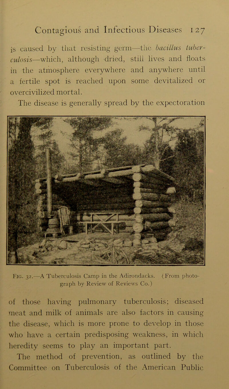 is caused by that resisting germ—the bacillus tuber- culosis—which, although dried, still lives and floats in the atmosphere everywhere and anywhere until a fertile spot is reached upon some devitalized or overcivilized mortal. The disease is generally spread by the expectoration Fig. 32.—A Tuberculosis Camp in the Adirondacks. (From photo- graph by Review of Reviews Co.) of those having pulmonary tuberculosis; diseased meat and milk of animals are also factors in causing the disease, which is more prone to develop in those who have a certain predisposing weakness, in which heredity seems to play an important part. The method of prevention, as outlined by the Committee on Tuberculosis of the American Public
