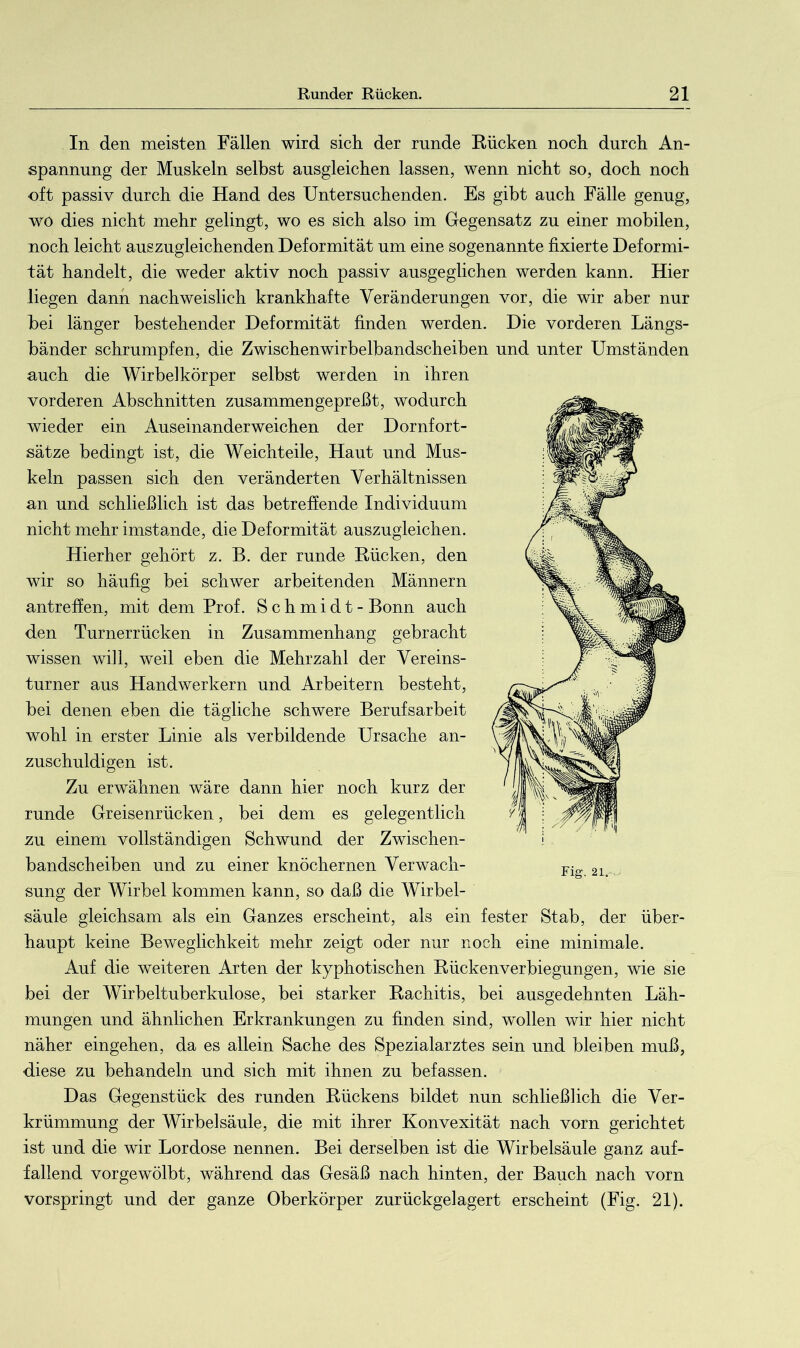 In den meisten Fällen wird sich der runde Rücken noch durch An- spannung der Muskeln selbst ausgleichen lassen, wenn nicht so, doch noch oft passiv durch die Hand des Untersuchenden. Es gibt auch Fälle genug, wo dies nicht mehr gelingt, wo es sich also im Gegensatz zu einer mobilen, noch leicht auszugleichenden Deformität um eine sogenannte fixierte Deformi- tät handelt, die weder aktiv noch passiv ausgeglichen werden kann. Hier liegen dann nachweislich krankhafte Veränderungen vor, die wir aber nur bei länger bestehender Deformität finden werden. Die vorderen Längs- bänder schrumpfen, die Zwischenwirbelbandscheiben und unter Umständen auch die Wirbelkörper selbst werden in ihren vorderen Abschnitten zusammengepreßt, wodurch wieder ein Auseinanderweichen der Dornfort- sätze bedingt ist, die Weichteile, Haut und Mus- keln passen sich den veränderten Verhältnissen an und schließlich ist das betreffende Individuum nicht mehr imstande, die Deformität auszugleichen. Hierher gehört z. B. der runde Rücken, den wir so häufig bei schwer arbeitenden Männern antreffen, mit dem Prof. Schmidt - Bonn auch den Turnerrücken in Zusammenhang gebracht wissen will, weil eben die Mehrzahl der Vereins- turner aus Handwerkern und Arbeitern besteht, bei denen eben die tägliche schwere Berufsarbeit wohl in erster Linie als verbildende Ursache an- zuschuldigen ist. Zu erwähnen wäre dann hier noch kurz der runde Greisenrücken, bei dem es gelegentlich zu einem vollständigen Schwund der Zwischen- bandscheiben und zu einer knöchernen Verwach- sung der Wirbel kommen kann, so daß die Wirbel- säule gleichsam als ein Ganzes erscheint, als ein fester Stab, der über- haupt keine Beweglichkeit mehr zeigt oder nur noch eine minimale. Auf die weiteren Arten der kyphotischen Rückenverbiegungen, wie sie bei der Wirbeltuberkulose, bei starker Rachitis, bei ausgedehnten Läh- mungen und ähnlichen Erkrankungen zu finden sind, wollen wir hier nicht näher eingehen, da es allein Sache des Spezialarztes sein und bleiben muß, diese zu behandeln und sich mit ihnen zu befassen. Das Gegenstück des runden Rückens bildet nun schließlich die Ver- krümmung der Wirbelsäule, die mit ihrer Konvexität nach vorn gerichtet ist und die wir Lordose nennen. Bei derselben ist die Wirbelsäule ganz auf- fallend vorgewölbt, während das Gesäß nach hinten, der Bauch nach vorn vorspringt und der ganze Oberkörper zurückgelagert erscheint (Fig. 21). Fig. 21.- -