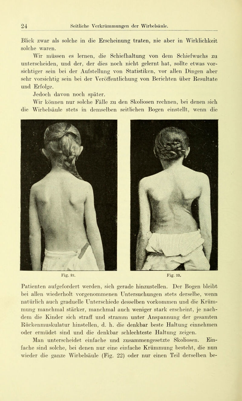 Blick zwar als solche in die Erscheinung traten, nie aber in Wirklichkeit solche waren. Wir müssen es lernen, die Schiefhaltung von dem Schiefwuchs zu unterscheiden, und der, der dies noch nicht gelernt hat, sollte etwas vor- sichtiger sein bei der Aufstellung von Statistiken, vor allen Dingen aber sehr vorsichtig sein bei der Veröffentlichung von Berichten über Resultate und Erfolge. Jedoch davon noch später. Wir können nur solche Fälle zu den Skoliosen rechnen, bei denen sich die Wirbelsäule stets in demselben seitlichen Bogen einstellt, wenn die Fig. 22. Fig. 23. Patienten aufgefordert werden, sich gerade hinzustellen. Der Bogen bleibt bei allen wiederholt vorgenommenen Untersuchungen stets derselbe, wenn natürlich auch graduelle Unterschiede desselben Vorkommen und die Krüm- mung manchmal stärker, manchmal auch weniger stark erscheint, je nach- dem die Kinder sich straff und stramm unter Anspannung der gesamten Rückenmuskulatur hinstellen, d. h. die denkbar beste Haltung einnehmen oder ermüdet sind und die denkbar schlechteste Haltung zeigen. Man unterscheidet einfache und zusammengesetzte Skoliosen. Ein- fache sind solche, bei denen nur eine einfache Krümmung besteht, die nun wieder die ganze Wirbelsäule (Fig. 22) oder nur einen Teil derselben be-