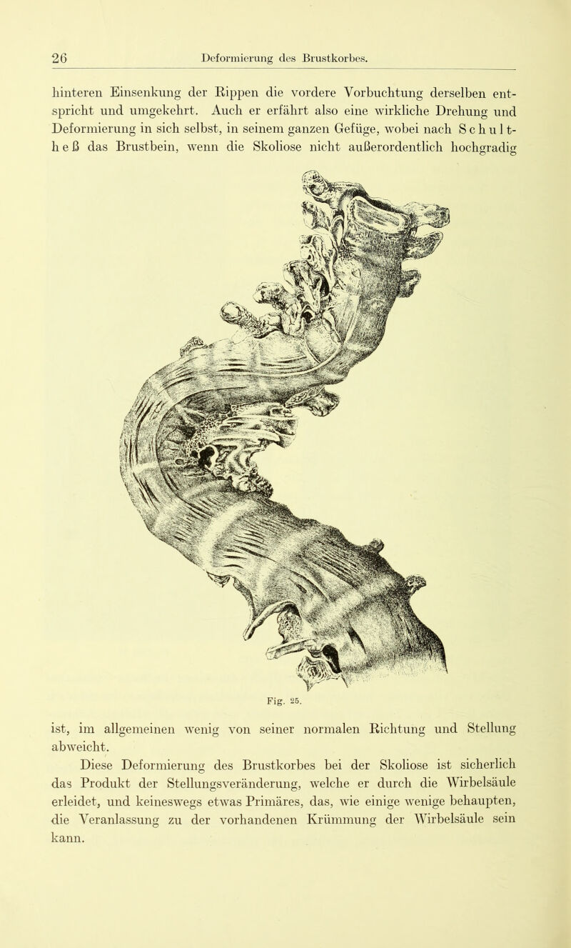 hinteren Einsenkung der Rippen die vordere Vorbuchtung derselben ent- spricht und umgekehrt. Auch er erfährt also eine wirkliche Drehung und Deformierung in sich selbst, in seinem ganzen Gefüge, wobei nach Schult- h e ß das Brustbein, wenn die Skoliose nicht außerordentlich hochgradig Fig. 25. ist, im allgemeinen wenig von seiner normalen Richtung und Stellung abweicht. Diese Deformierung des Brustkorbes bei der Skoliose ist sicherlich das Produkt der Stellungsveränderung, welche er durch die Wirbelsäule erleidet, und keineswegs etwas Primäres, das, wie einige wenige behaupten, die Veranlassung zu der vorhandenen Krümmung der Wirbelsäule sein kann.