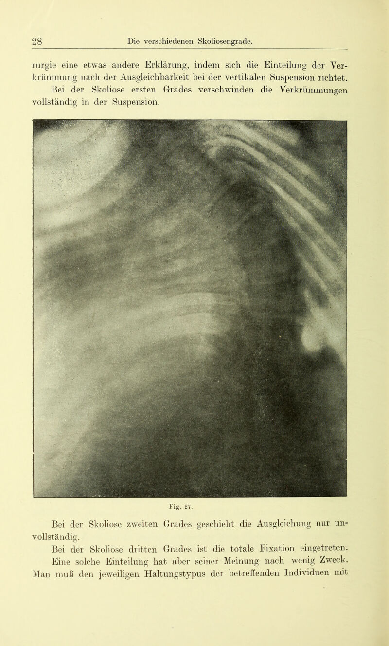 rurgie eine etwas andere Erklärung, indem sich die Einteilung der Ver- krümmung nach der Ausgleichbarkeit bei der vertikalen Suspension richtet. Bei der Skoliose ersten Grades verschwinden die Verkrümmungen vollständig in der Suspension. Fig. 27. Bei der Skoliose zweiten Grades geschieht die Ausgleichung nur un- vollständig. Bei der Skoliose dritten Grades ist die totale Fixation eingetreten. Eine solche Einteilung hat aber seiner Meinung nach wenig Zweck. Man muß den jeweiligen Haltungstypus der betreffenden Individuen mit