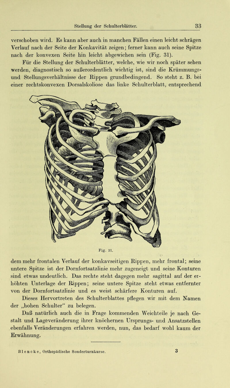 verschoben wird. Es kann aber auch in manchen Fällen einen leicht schrägen Verlauf nach der Seite der Konkavität zeigen; ferner kann auch seine Spitze nach der konvexen Seite hin leicht abgewichen sein (Fig. 31). Für die Stellung der Schulterblätter, welche, wie wir noch später sehen werden, diagnostisch so außerordentlich wichtig ist, sind die Krümmungs- und Stellungsverhältnisse der Kippen grundbedingend. So steht z. B. bei einer rechtskonvexen Dorsalskoliose das linke Schulterblatt, entsprechend dem mehr frontalen Verlauf der konkavseitigen Rippen, mehr frontal; seine untere Spitze ist der Dornfortsatzlinie mehr zugeneigt und seine Konturen sind etwas undeutlich. Das rechte steht dagegen mehr sagittal auf der er- höhten Unterlage der Rippen; seine untere Spitze steht etwas entfernter von der Dornfortsatzlinie und es weist schärfere Konturen auf. Dieses Hervortreten des Schulterblattes pflegen wir mit dem Namen der „hohen Schulter“ zu belegen. Daß natürlich auch die in Frage kommenden Weichteile je nach Ge- stalt und Lageveränderung ihrer knöchernen Ursprungs- und Ansatzstellen ebenfalls Veränderungen erfahren werden, nun, das bedarf wohl kaum der Erwähnung. ßlencke, Orthopädische Sonderturnkurse. 3