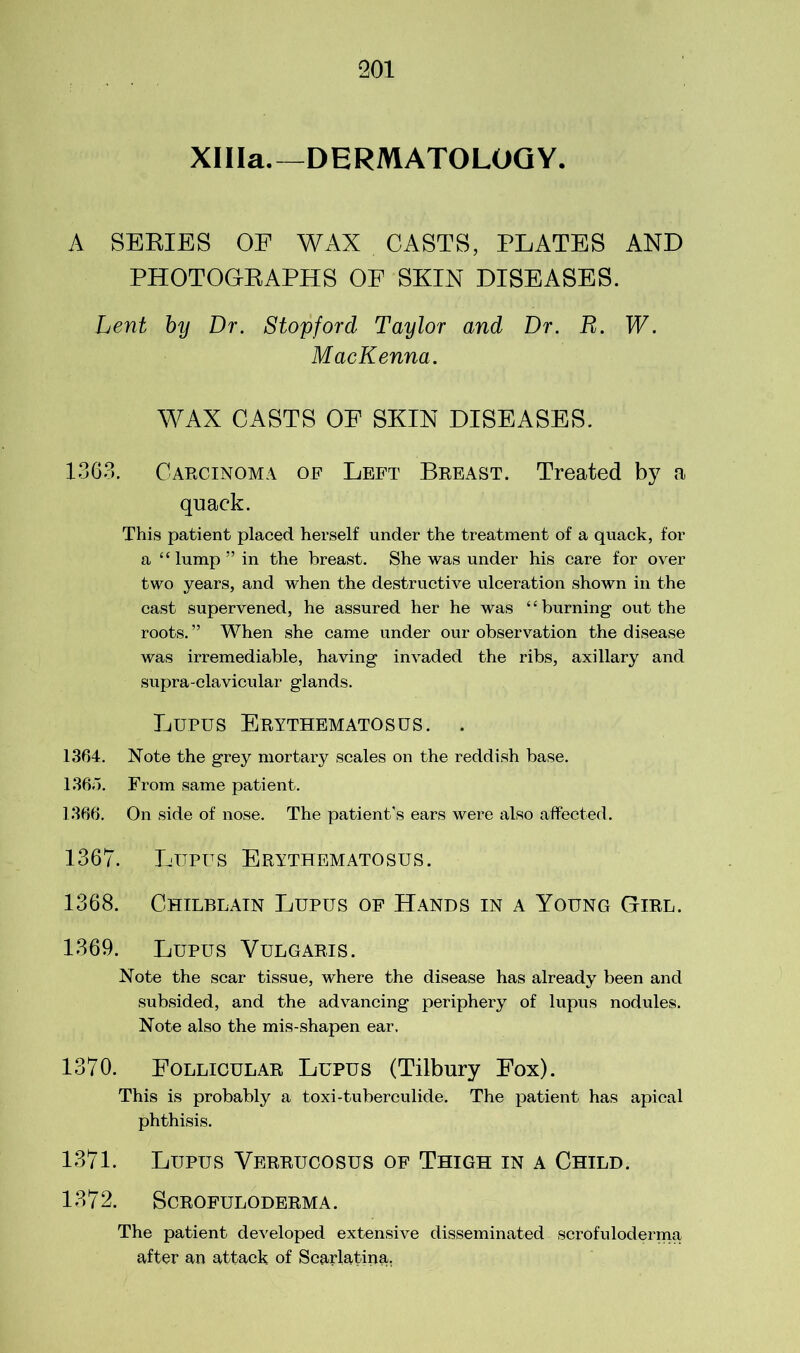 XHIa.—DERMATOLOGY. A SERIES OE WAX CASTS, PLATES AND PHOTOGRAPHS OF SKIN DISEASES. Lent by Dr. Stopford Taylor and Dr. R. W. MacKenna. WAX CASTS OF SKIN DISEASES. 1363. Carcinoma of Left Breast. Treated by a quack. This patient placed herself under the treatment of a quack, for a “lump” in the breast. She was under his care for over two years, and when the destructive ulceration shown in the cast supervened, he assured her he was ‘ ‘ burning out the roots. ” When she came under our observation the disease was irremediable, having invaded the ribs, axillary and supra-clavicular glands. Lupus Erythematosus. . 1364. Note the grey mortary scales on the reddish base. 1365. From same patient. 1366. On side of nose. The patient’s ears were also affected. 1367. Lupus Erythematosus. 1368. Chilblain Lupus of Hands in a Young Girl. 1369. Lupus Vulgaris. Note the scar tissue, where the disease has already been and subsided, and the advancing periphery of lupus nodules. Note also the mis-shapen ear, 1370. Follicular Lupus (Tilbury Fox). This is probably a toxi-tuberculide. The patient has apical phthisis. 1371. Lupus Verrucosus of Thigh in a Child. 1372. Scrofuloderma. The patient developed extensive disseminated scrofuloderma after an attack of Scarlatina.