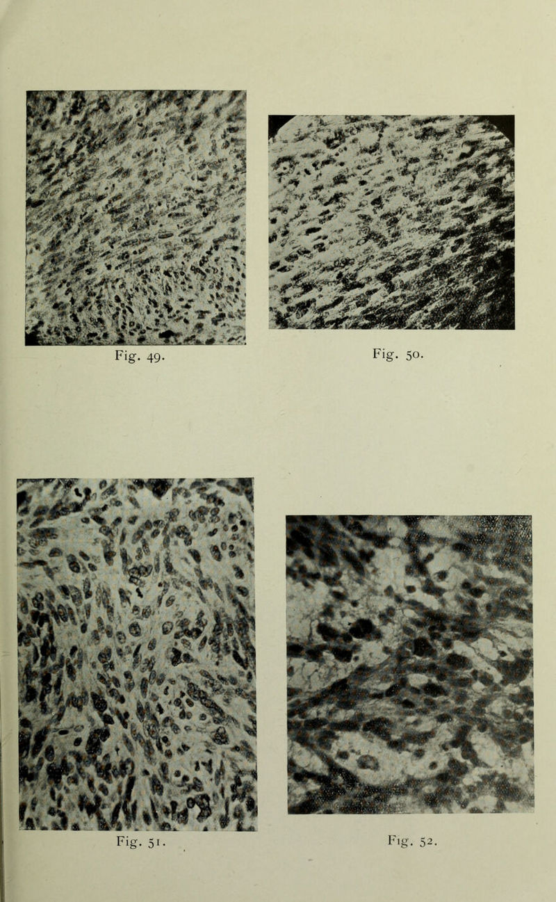 Fig. 5i- Fig. 52.