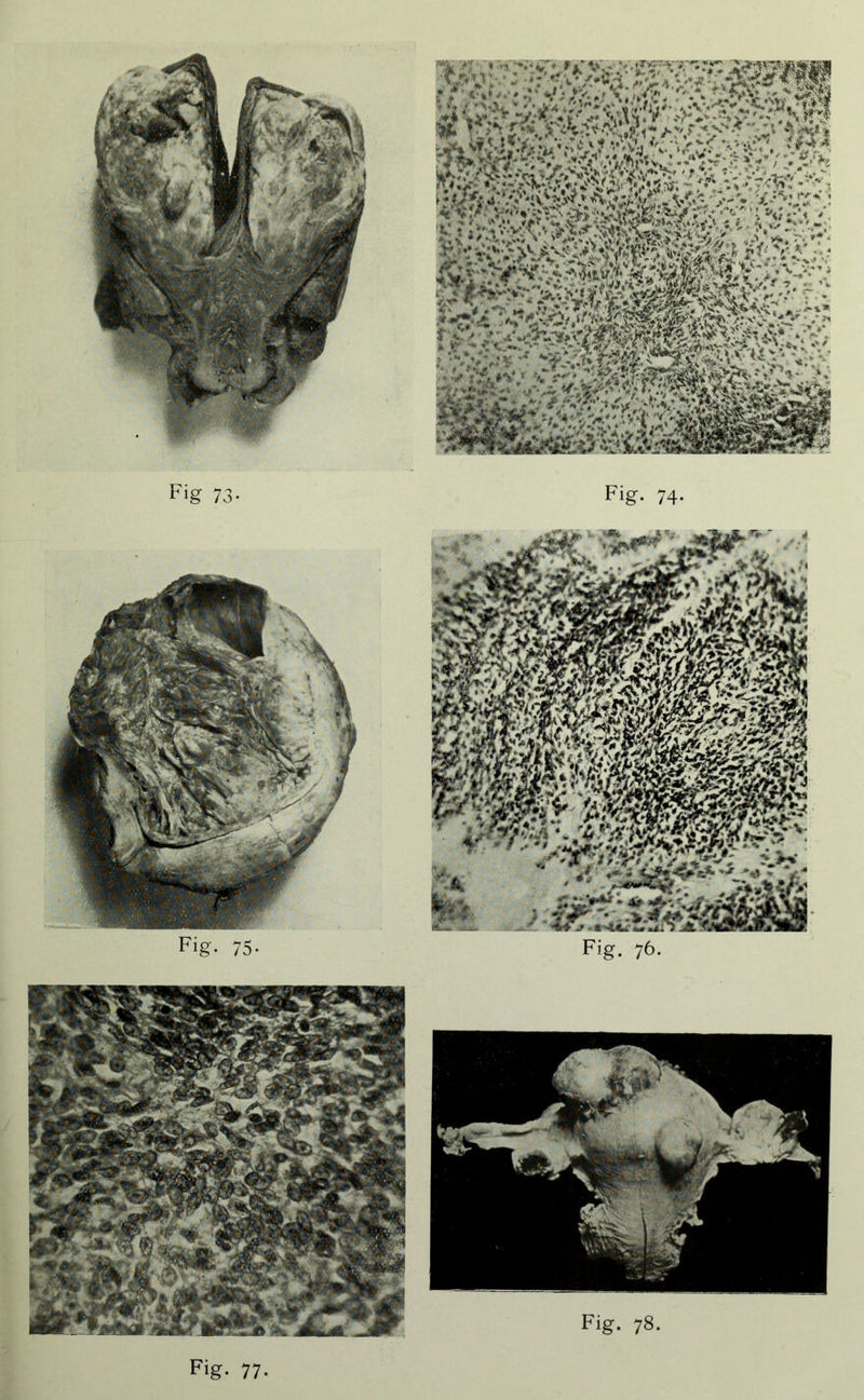 Fig- 75- Fig. 76- Fig- 77-