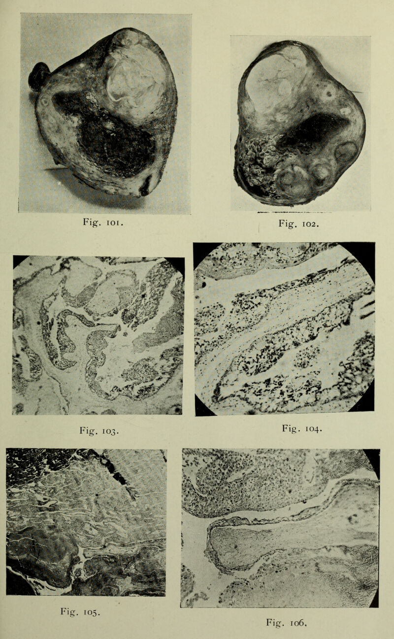 Fig. 103. Fig. 104. Fig. 106, Fig. 105