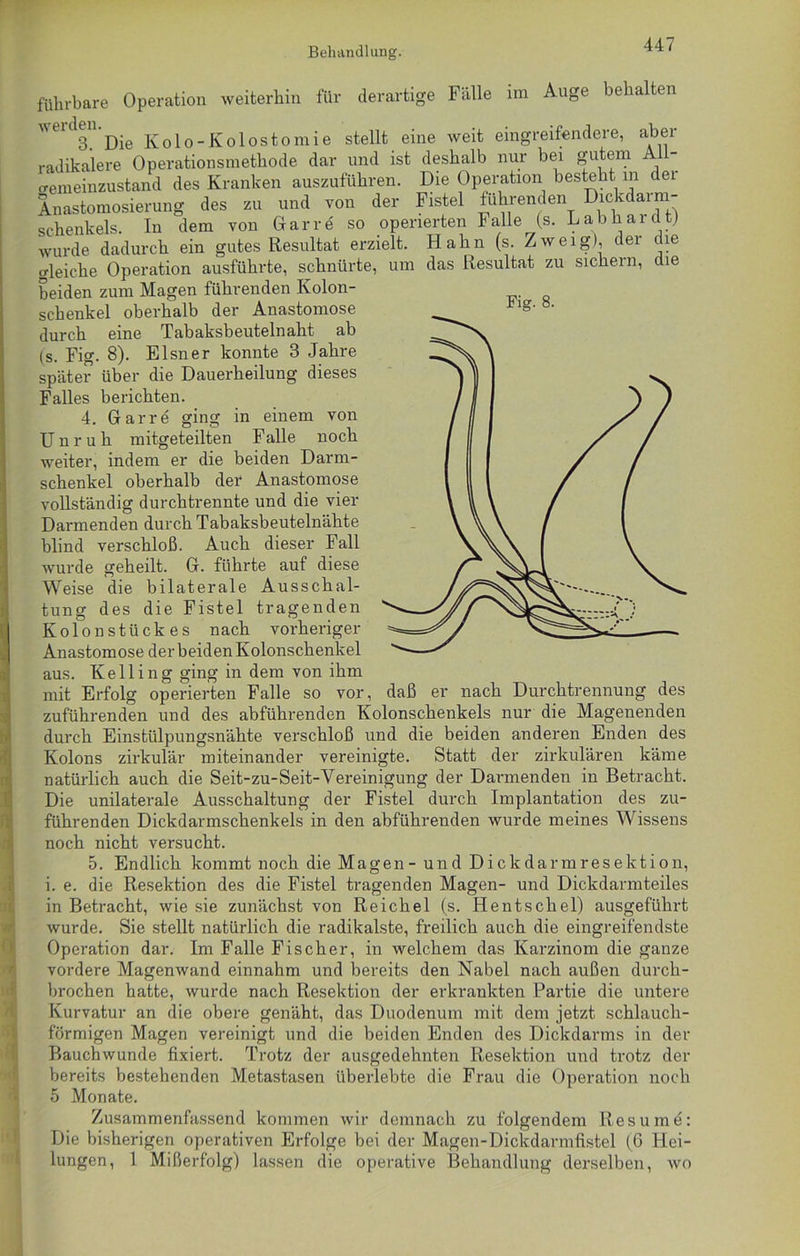 Behandlung. Fig. 8. führbare Operation weiterhin für derartige Fälle im Auge behalten Die Kolo-Kolostomie stellt eine weit eingreifendere, aber radikalere Operationsmethode dar und ist deshalb nur bei gutem Ail- o-emeinzustand des Kranken auszuführen. Die Operation besteht in dei Anastomosierung des zu und von der Fistel führenden Dickdarm- schenkels. In dem von Gar re so operierten Falle (s. Lab har dt) wurde dadurch ein gutes Resultat erzielt. Hahn (s. Zweig), der che gleiche Operation ausführte, schnürte, um das Resultat zu sichern, die beiden zum Magen führenden Kolon- schenkel oberhalb der Anastomose durch eine Tabaksbeutelnaht ab (s. Fig. 8). Elsner konnte 3 Jahre später über die Dauerheilung dieses Falles berichten. 4. darre ging in einem von Unruh mitgeteilten F alle noch weiter, indem er die beiden Darm- schenkel oberhalb der Anastomose vollständig durchtrennte und die vier Darmenden durch Tabaksbeutelnähte blind verschloß. Auch dieser Fall wurde geheilt. G. führte auf diese Weise die bilaterale Ausschal- tung des die Fistel tragenden Kolonstückes nach vorheriger Anastomose der beiden Kolonschenkel aus. Kelling ging in dem von ihm mit Erfolg operierten Falle so vor, daß er nach Durchtrennung des zuführenden und des abführenden Kolonschenkels nur die Magenenden durch Einstülpungsnähte verschloß und die beiden anderen Enden des Kolons zirkulär miteinander vereinigte. Statt der zirkulären käme natürlich auch die Seit-zu-Seit-Vereinigung der Darmenden in Betracht. Die unilaterale Ausschaltung der Fistel durch Implantation des zu- führenden Dickdarmschenkels in den abführenden wurde meines Wissens noch nicht versucht. 5. Endlich kommt noch die Magen - und D ickdarm resektion, i. e. die Resektion des die Fistel tragenden Magen- und Dickdarmteiles in Betracht, wie sie zunächst von Reichel (s. Hentschel) ausgeführt wurde. Sie stellt natürlich die radikalste, freilich auch die eingreifendste Operation dar. Im Falle Fischer, in welchem das Karzinom die ganze vordere Magenwand einnahm und bereits den Nabel nach außen durch- brochen hatte, wurde nach Resektion der erkrankten Partie die untere Kurvatur an die obere genäht, das Duodenum mit dem jetzt schlauch- förmigen Magen vereinigt und die beiden Enden des Dickdarms in der Bauchwunde fixiert. Trotz der ausgedehnten Resektion und trotz der bereits bestehenden Metastasen überlebte die Fran die Operation noch 5 Monate. Zusammenfassend kommen wir demnach zu folgendem Resume: Die bisherigen operativen Erfolge bei der Magen-Dickdarmfistel (6 Hei- lungen, 1 Mißerfolg) lassen die operative Behandlung derselben, wo