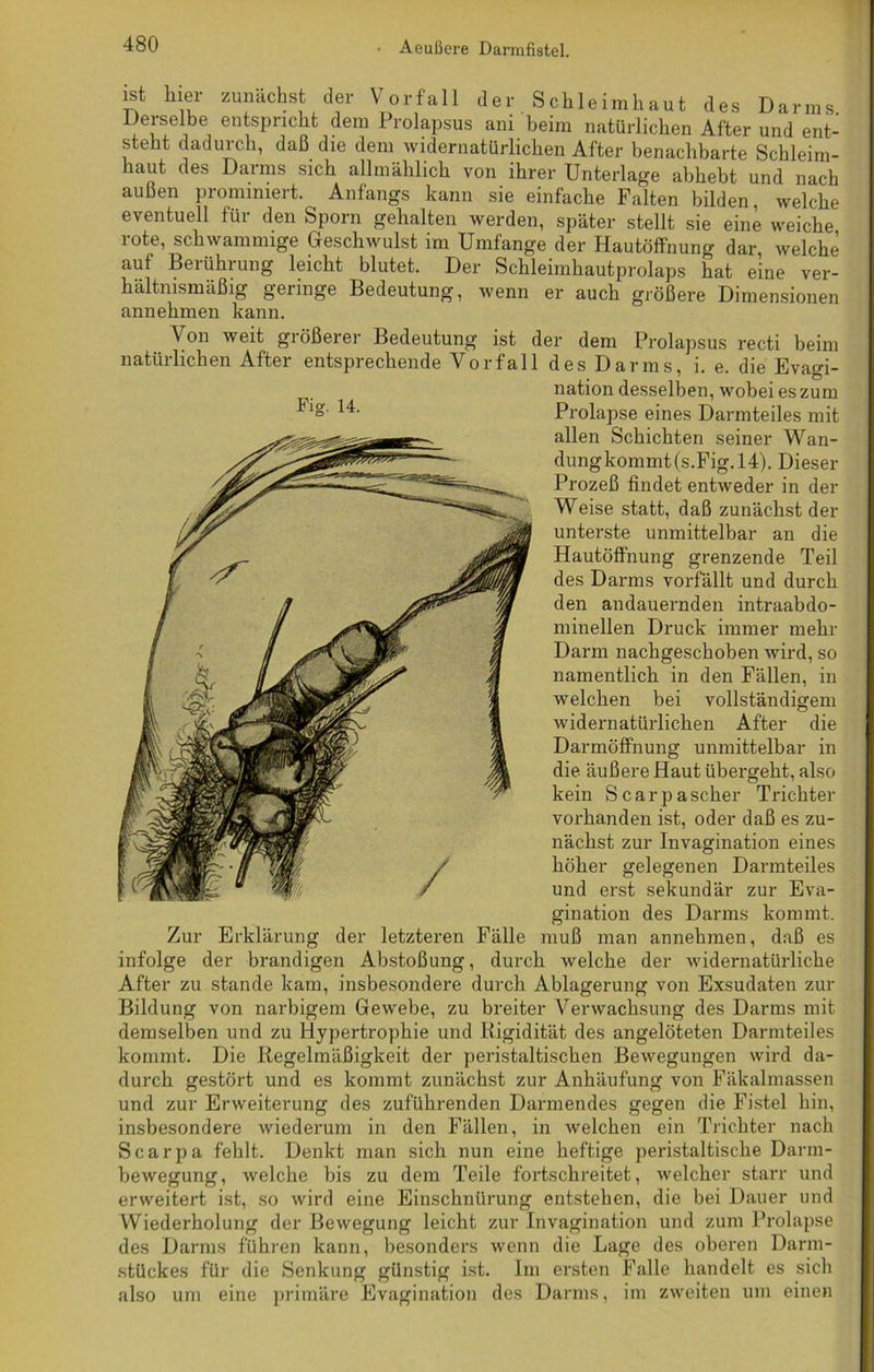 ist hier zunächst der Vorfall der Schleimhaut des Darms Derselbe entspricht dem Prolapsus ani beim natürlichen After und ent- steht dadurch, daß die dem widernatürlichen After benachbarte Schleim- haut des Darms sich allmählich von ihrer Unterlage abhebt und nach außen prommiert. Anfangs kann sie einfache Falten bilden welche eventuell für den Sporn gehalten werden, später stellt sie eine weiche rote, schwammige Geschwulst im Umfange der Hautöffnung dar welche auf Berührung leicht blutet. Der Schleimhautprolaps hat eine ver- hältnismäßig geringe Bedeutung, wenn er auch größere Dimensionen annehmen kann. Von weit größerer Bedeutung ist der dem Prolapsus recti beim natürlichen After entsprechende Vorfall des Darms, i. e. die Evao-i- , ' O nation desselben, wobei es zum Prolapse eines Darmteiles mit allen Schichten seiner Wan- dung kommt(s.Fig. 14). Dieser Prozeß findet entweder in der Weise statt, daß zunächst der unterste unmittelbar an die Hautöffnung grenzende Teil des Darms vorfällt und durch den andauernden intraabdo- minellen Druck immer mehr Darm nachgeschoben wird, so namentlich in den Fällen, in welchen bei vollständigem widernatürlichen After die Darmöffnung unmittelbar in die äußere Haut übergeht, also kein S c a r p a scher Trichter vorhanden ist, oder daß es zu- nächst zur Invagination eines höher gelegenen Darmteiles und erst sekundär zur Eva- gination des Darms kommt. Zur Erklärung der letzteren Fälle muß man annehmen, daß es infolge der brandigen Abstoßung, durch welche der widernatürliche After zu stände kam, insbesondere durch Ablagerung von Exsudaten zur Bildung von narbigem Gewebe, zu breiter Verwachsung des Darms mit demselben und zu Hypertrophie und Rigidität des angelöteten Darmteiles kommt. Die Regelmäßigkeit der peristaltischen Bewegungen wird da- durch gestört und es kommt zunächst zur Anhäufung von Fäkalmassen und zur Erweiterung des zuführenden Darmendes gegen die Fistel hin, insbesondere wiederum in den Fällen, in welchen ein Trichter nach Scarpa fehlt. Denkt man sich nun eine heftige peristaltische Darm- bewegung, welche bis zu dem Teile fortschreitet, welcher starr und erweitert ist, so wird eine Einschnürung entstehen, die bei Dauer und Wiederholung der Bewegung leicht zur Invagination und zum Prolapse des Darms führen kann, besonders wenn die Lage des oberen Darm- stückes für die Senkung günstig ist. Im ersten Falle handelt es sich also um eine primäre Evagination des Darms, im zweiten um einen