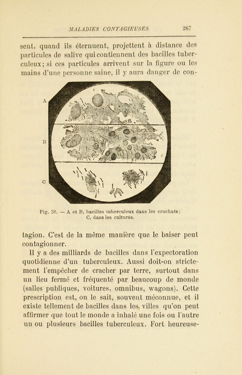 sent, quand ils éternuent, projettent à distance des particules de salive qui contiennent des bacilles tuber- culeux; si ces particules arrivent sur la figure ou les mains d’une personne saine, il y aura danger de con- Fig. 38. — A et B, bacilles tuberculeux dans les crachats ; C, dans les cultures. tagion. C’est de la même manière que le baiser peut contagionner. 11 y a des milliards de bacilles dans l’expectoration quotidienne d’un tuberculeux. Aussi doit-on stricte- ment l’empêcher de cracher par terre, surtout dans un lieu fermé et fréquenté par beaucoup de monde (salles publiques, voitures, omnibus, wagons). Cette prescription est, on le sait, souvent méconnue, et il existe tellement de bacilles dans les villes qu’on peut affirmer que tout le monde a inhalé une fois ou l'autre un ou plusieurs bacilles tuberculeux. Fort heureuse-