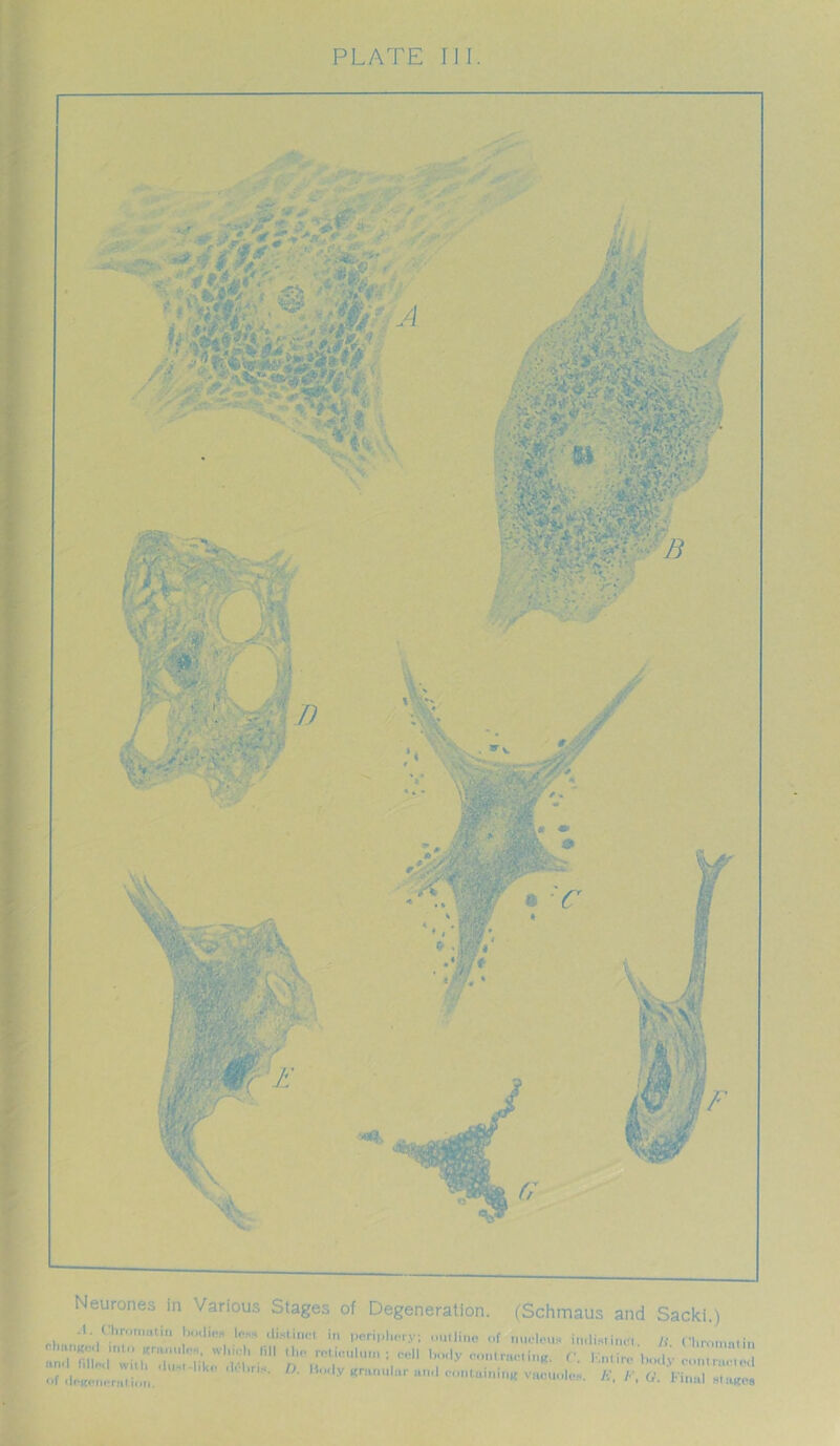 Neurones in Various Stages of Degeneration. (Schmaus and Sacki ) r::;::;. **> * *« - wrens