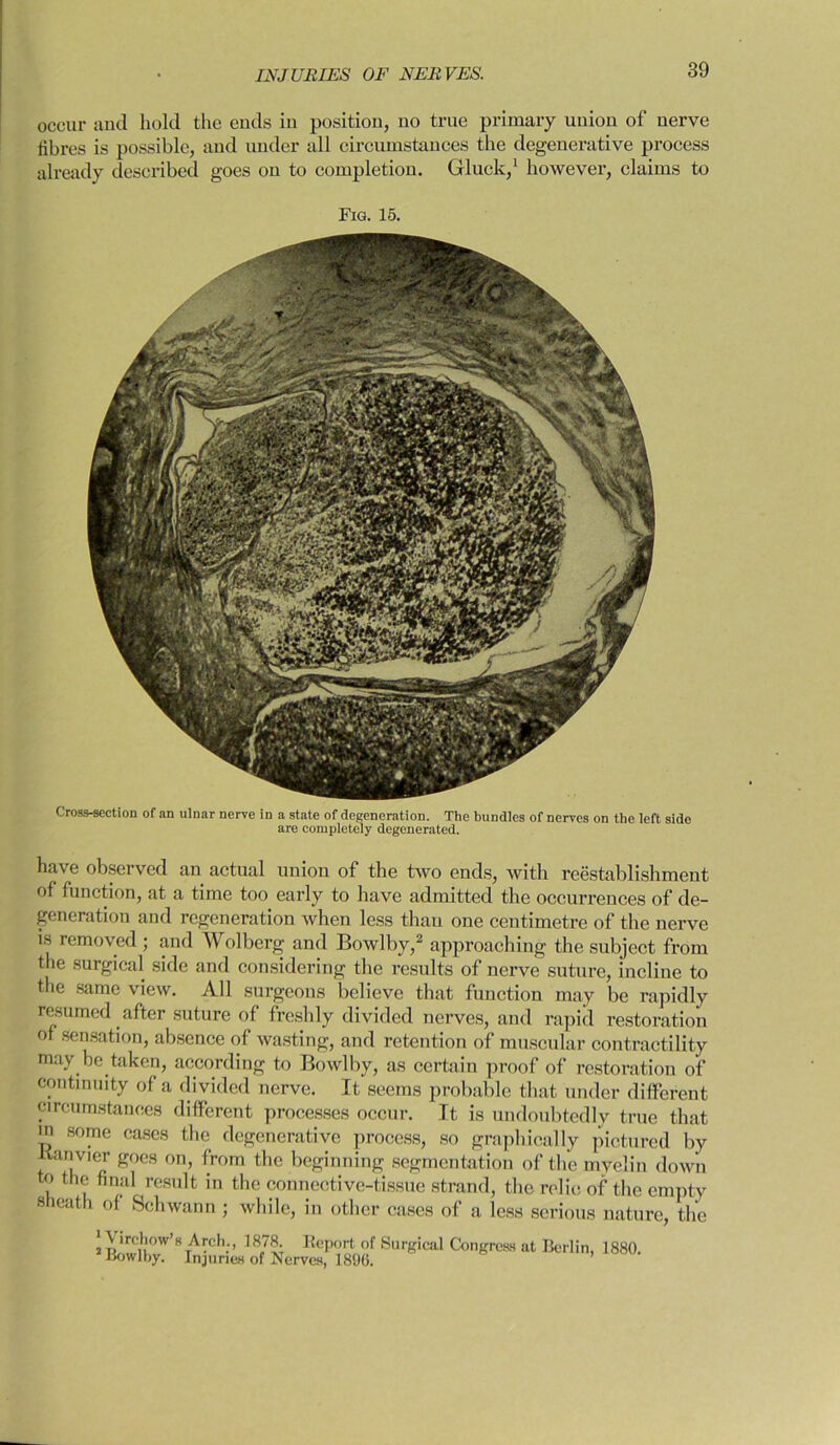 occur and hold the ends in position, no true primary union of nerve fibres is possible, and under all circumstances the degenerative process already described goes on to completion. Gluck,1 however, claims to Fig. 15. Cross-section of an ulnar nerve in a state of degeneration. The bundles of nerves on the left side are completely degenerated. have observed an actual union of the two ends, with reestablishment of function, at a time too early to have admitted the occurrences of de- generation and regeneration when less than one centimetre of the nerve is removed ; and Wolberg and Bowlby,2 approaching the subject from the surgical side and considering the results of nerve suture, incliue to the same view. All surgeons believe that function may be rapidly resumed after suture of freshly divided nerves, and rapid restoration of sensation, absence of wasting, and retention of muscular contractility may be taken, according to Bowlby, as certain proof of restoration of continuity of a divided nerve. It seems probable that under different circumstances different processes occur. It is undoubtedly true that in some cases the degenerative process, so graphically pictured by Kanvier goes on, from the beginning segmentation of the myelin down o the final result in the connective-tissue strand, the relic of the empty sheath of Schwann ; while, in other cases of a less serious nature, the ‘Virchow’s Areh., 1878. Report of Surgical Congress at Berlin, 1880. Bowlby. Injuries of Nerves, 1896.