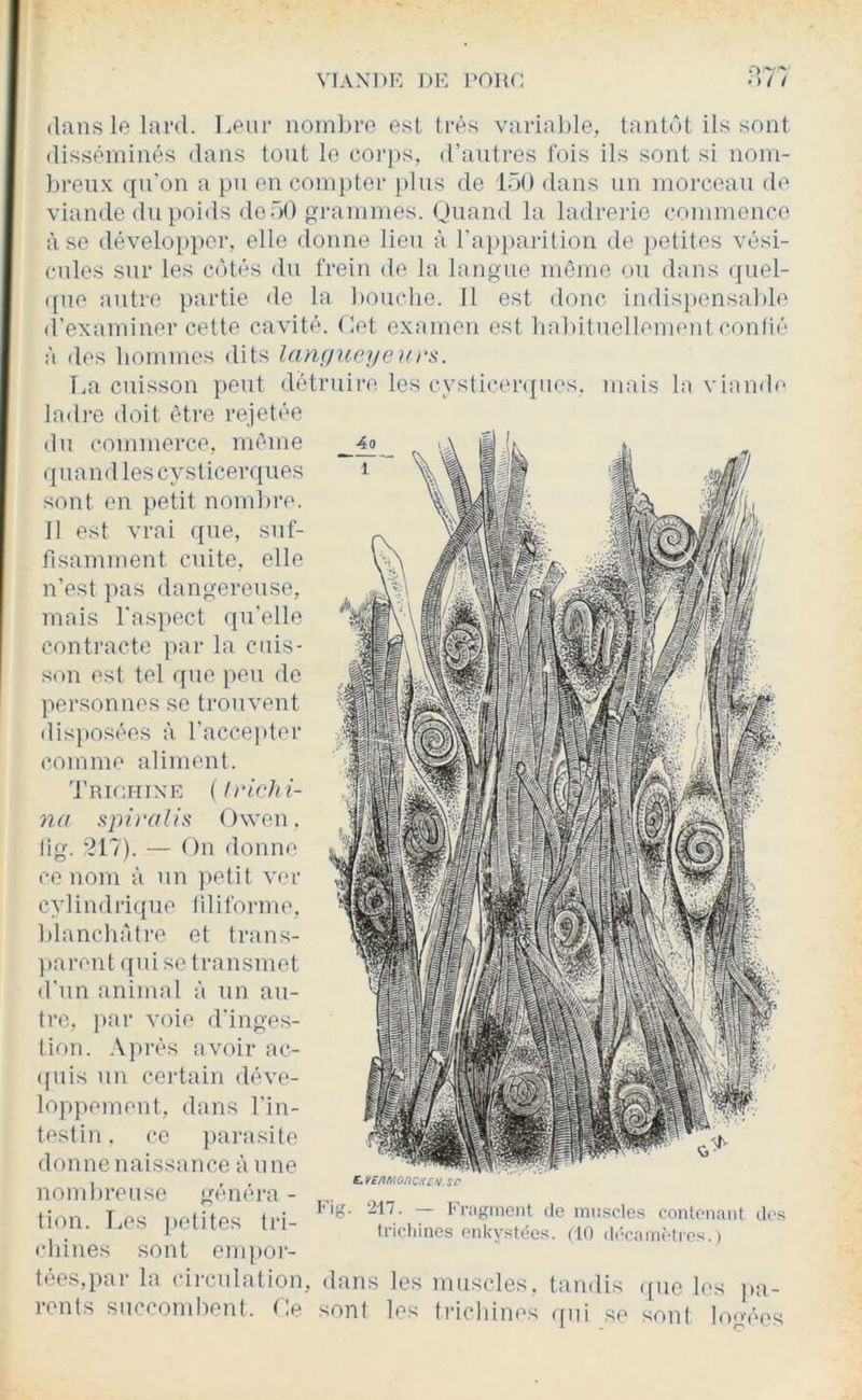 dans lo lard, lieiir nom].)re est t)-è.s variable, tantôt ils sont disséminés dans tout le coi'ps, d'antres fois ils sont si nom- breux qn'on a pn en com})ter plus de lôO dans un morceau de viande du poids doüO o-rammes. Ouand la ladrerie commence à se déveloi)por, elle donne lieu à l'a])parition de jjetites vési- cules sur les côtés du frein de la langue môme ou dans (|uel- ([ue autre partie de la bouclie. Il est donc indispensable (l'examiner cette cavité, (tet examen est ba))itue]lement conlié à des hommes dits lançiucyeurs. T.a cuisson peut détruii'e les cysticenpies. mais la viando ladi-e doit être rejetée (lu commerce, môme (tnandlescysticer((ues sont en petit nombre. Il est vrai c{ue, suf- fisamment cuite, elle n’est ]ias dangereuse, mais l'aspect ({u'elle contracte par la cuis- son est tel que peu de personnes se trouvent dis}»osées à l'accepter comme aliment. ’J'RiraiixE {Irichi- na spu'alis Owen. tig. — On donne ce nom à un petit ver c y 1 i n (1 ri ({n e I i 1 i fo rm e, blanchâtre et trans- })arent qui se transmet (l'nn animal à un an- tre, par voie d'inges- ti('»n. Après avoir ac- ((uis un certain déve- lopjiement, dans l'in- testin . ce parasite donne naissance à nue nombreuse généra - tion T ev: nolitpv.: ici de nu i.scies contenant dos tnm. Des petites tll- trichines enUvsa'es. (lo ,|,Vam;.tios. > (•lunes sont empor- tées,pai- la circulation, dans les muscles, ttindis (pie les pa- rents succombent. O sont les trichines qui se sont logées
