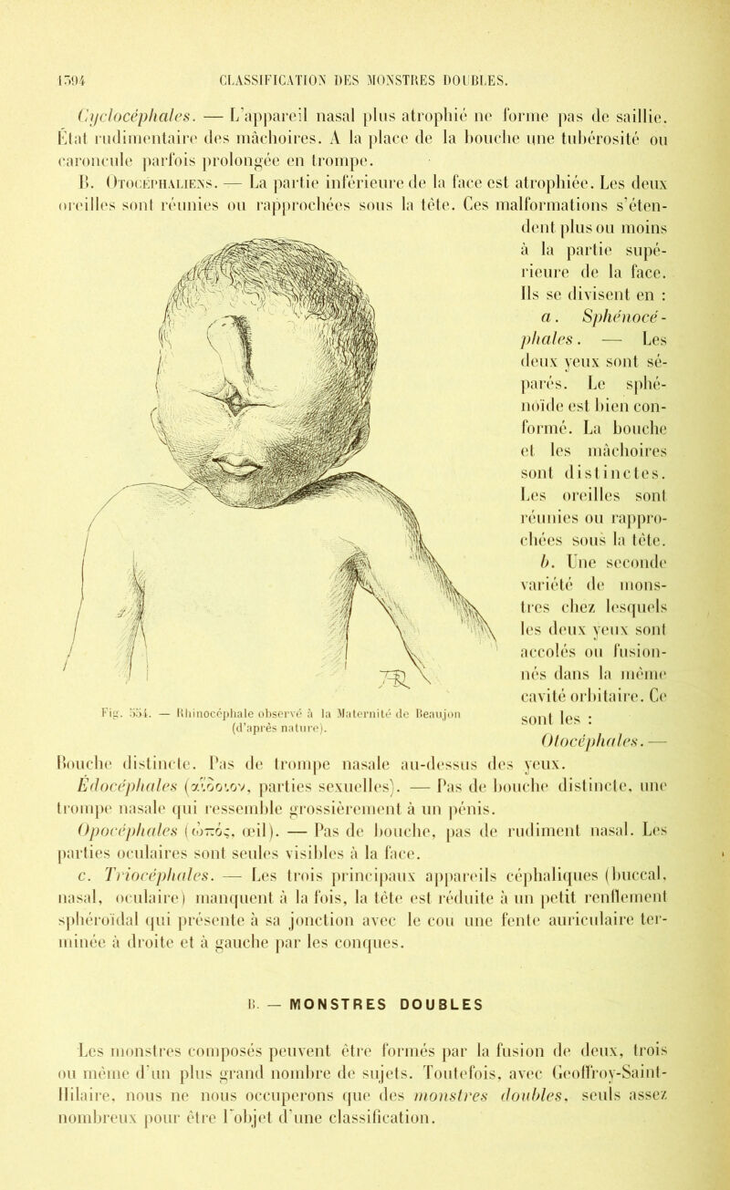Cyclocéphales. — L’appareil nasal plus atrophié ne forme pas de saillie. État rudimentaire des mâchoires. A la place de la bouche une tubérosité ou caroncule parfois prolongée en trompe. B. Otocéphaliens. — La partie inférieure de la face est atrophiée. Les deux oreilles sont réunies ou rapprochées sous la tête. Ces malformations s’éten- dent plus ou moins à la partie supé- rieure de la face. Ils se divisent en : a. Sphénocé - pliâtes. — Les deux yeux sont sé- parés. Le sphé- noïde est bien con- formé. La bouche et les mâchoires sont distinctes. Les oreilles sont réunies ou rappro- chées sous la tête. b. Une seconde variété de mons- tres chez lesquels les deux yeux sont accolés ou fusion- nés dans la même cavité orbitaire. Ce sont les : Otocèphales. — Bouche distincte. Pas de trompe nasale au-dessus des yeux. Edocéphales (al'oo'.ov, parties sexuelles). — Pas de bouche distincte, une trompe nasale qui ressemble grossièrement à un pénis. Opocéphales (to-ôq, œil). — Pas de bouche, pas de rudiment nasal. Les parties oculaires sont seules visibles à la face. c. Triocéphciles. — Les trois principaux appareils céphaliques (buccal, nasal, oculaire) manquent â la fois, la tête est réduite à un petit renflement sphéroidal qui présente à sa jonction avec le cou une fente auriculaire ter- minée à droite et à gauche par les conques. Fig. 554. — Bhinocéphale observé à la Maternité de Beaujon (d’après nature). B. - MONSTRES DOUBLES Les monstres composés peuvent être formés par la fusion de deux, trois ou même d’un plus grand nombre de sujets. Toutefois, avec Geoffroy-Saint- llilaire, nous ne nous occuperons que des monstres doubles, seuls assez nombreux pour être l’objet d une classification.