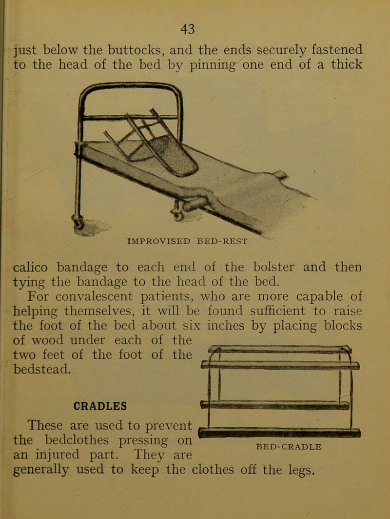 IMPROVISED BED-REST just below the buttocks, and the ends securely fastened to the head of the bed by pinning one end of a thick calico bandage to each end of the bolster and then tying the bandage to the head of the bed. For convalescent patients, who are more capable of helping themselves, it will be found sufficient to raise the foot of the bed about six inches by placing blocks of wood under each of the ^ two feet of the foot of the ' T bedstead. CRADLES These are used to prevent , the bedclothes pressing on an injured part. They are generally used to keep the clothes off the legs. BED-CRADLE