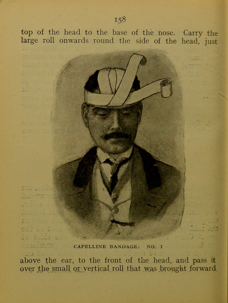 top of the head to the base of the nose. Carry the large roll onwards round the side of the head, just CAPELLINE BANDAGE; NO. I above the ear, to the front of the head, and pass it over the small ox.vertical roll that .was .brought forward