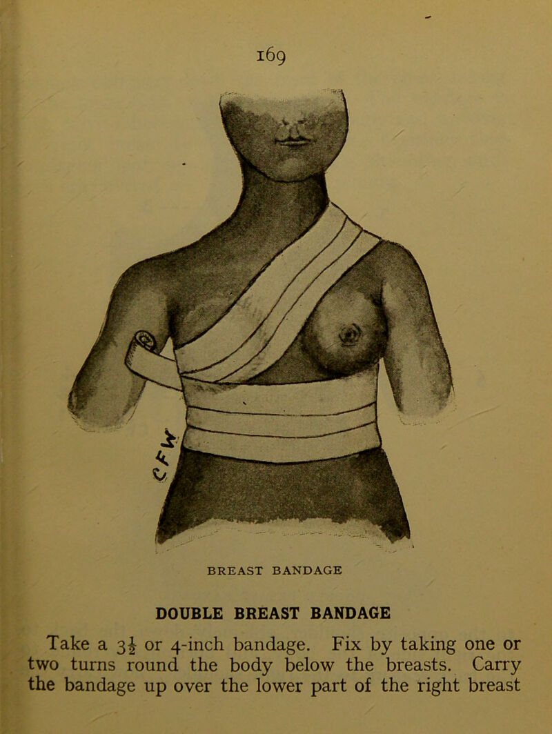 BREAST BANDAGE DOUBLE BREAST BANDAGE Take a 3I or 4-inch bandage. Fix by taking one or two turns round the body below the breasts. Carry the bandage up over the lower part of the right breast