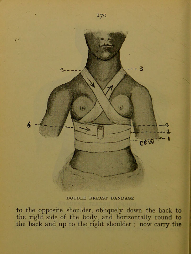DOUBLE BREAST BANDAGE to the opposite shoulder, obliquely down the back to the right side of the body, and horizontally round to the back and up to the right shoulder ; now carry the