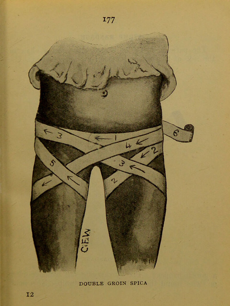 DOUBLE GROIN SPICA 12