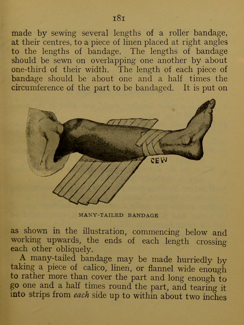 made by sewing several lengths of a roller bandage, at their centres, to a piece of linen placed at right angles to the lengths of bandage. The lengths of bandage should be sewn on overlapping one another by about one-third of their width. The length of each piece of bandage should be about one and a half times the circumference of the part to be bandaged. It is put on MANY-TAILED BANDAGE as shown in the illustration, commencing below and working upwards, the ends of each length crossing each other obliquely. A many-tailed bandage may be made hurriedly by taking a piece of calico, linen, or flannel wide enough to rather more than cover the part and long enough to go one and a half times round the part, and tearing it into strips from each side up to within about two inches