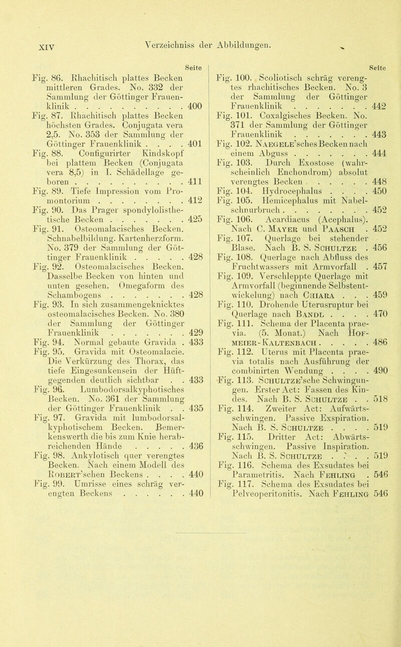 Seite Fig. 86. Rhachitisch plattes Becken mittleren Grades. No. 332 der Sammlung der Göttinger Frauen- klinik 400 Fig. 87. Rhachitisch plattes Becken höchsten Grades. Conjugata yera 2,5. No. 353 der Sammlung der Göttinger Frauenklinik . . . .401 Fig. 88. Configurirter Kindskopf bei plattem Becken (Conjugata vera 8,5) in I. Schädellage ge- boren 411 Fig. 89. Tiefe Impression vom Pro- montorium 412 Fig. 90. Das Prager spondylolisthe- tische Becken 425 Fig. 91. Osteomalacisches Becken. Schnabelbildung. Kartenherzform. No. 379 der Sammlung der Göt- tinger Frauenklinik 428 Fig. 92. Osteomalacisches Becken. Dasselbe Becken von hinten und unten gesehen. Omegaform des Schambogens 428 Fig. 93. In sich zusammengeknicktes osteomalacisches Becken. No. 380 der Sammlung der Göttinger Frauenklinik 429 Fig. 94. Normal gebaute Gravida . 433 Fig. 95. Gravida mit Osteomalacie. Die Verkürzung des Thorax, das tiefe Eingesunkensein der Hiift- gegenden deutlich sichtbar . . 433 Fig. 96. Lumbodorsalkyphotisches Becken. No. 361 der Sammlung der Göttinger Frauenklinik . . 435 Fig. 97. Gravida mit lumbodorsal- kyphotisckem Becken. Bemer- kenswerth die bis zum Knie herab- reichenden Hände 436 Fig. 98. Ankylotisch quer verengtes Becken. Nach einem Modell des RoBERT’schen Beckens .... 440 Fig. 99. Umrisse eines schräg ver- engten Beckens ...... 440 Seite Fig. 100. . Scoliotisch schräg vereng- tes rhachitisches Becken. No. 3 der Sammlung der Göttinger Frauenklinik 442 Fig. 101. Coxalgisch.es Becken. No. 371 der Sammlung der Göttinger Frauenklinik 443 Fig. 102. NAEGrELE’sches Becken nach einem Abguss 444 Fig. 103. Durch Exostose (wahr- scheinlich Enchondrom) absolut verengtes Becken 448 Fig. 104. Hydrocephalus .... 450 Fig. 105. Hemicephalus mit Nabel- schnurbruch 452 Fig. 106. Acardiacus (Acephalus). Nach C. Mayer und Paasch . 452 Fig. 107. Querlage bei stehender Blase. Nach B. S. Schultze . 456 Fig. 108. Querlage nach Abfluss des Fruchtwassers mit Arm Vorfall . 457 Fig. 109. Verschleppte Querlage mit Armvorfall (beginnende Selbstent- wickelung) nach Chiara . . . 459 Fig. 110. Drohende Uterusruptur bei Querlage nach Ban dl . . . . 470 Fig. 111. Schema der Placenta prae- via. (5. Monat.) Nach IIof- meier-Kaltenbach 486 Fig. 112. Uterus mit Placenta prae- via totalis nach Ausführung der combinirten Wendung .... 490 Fig. 113. ScHULTZE’sche Schwingun- gen. Erster Act: Fassen des Kin- des. Nach B. S. Schultze . . 518 Fig. 114. Zweiter Act: Aufwärts- schwingen. Passive Exspiration. Nach B. S. Schultze .... 519 Fig. 115. Dritter Act: Abwärts- schwingen. Passive Inspiration. Nach B. S. Schultze . . . 519 Fig. 116. Schema des Exsudates bei Parametritis. Nach Fehling- . 546 Fig. 117. Schema des Exsudates bei Pelveoperitonitis. Nach Fehling 546