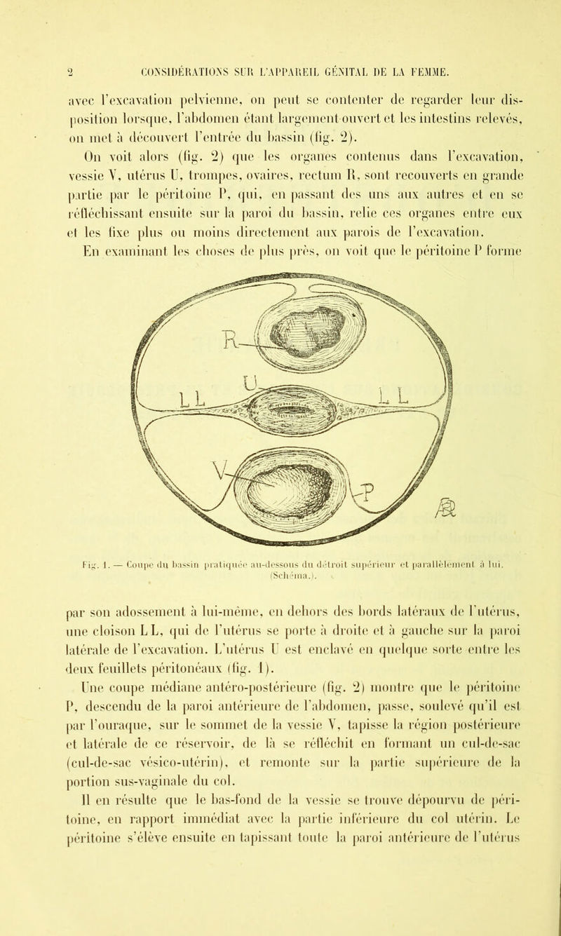 avec l’excavation pelvienne, on peut se contenter de regarder leur dis- position lorsque, l'abdomen étant largement ouvert et les intestins relevés, on met à découvert l’entrée du bassin (fig. 2). On voit alors (fig. 2) que les organes contenus dans l’excavation, vessie Y, utérus U, trompes, ovaires, rectum R, sont recouverts en grande partie par le péritoine P, qui, en passant des uns aux autres et en se réfléchissant ensuite sur la paroi du bassin, relie ces organes entre eux et les fixe plus ou moins directement aux parois de l’excavation. En examinant les choses de plus près, on voit que le péritoine P forme Fig. 1. — Coupe du bassin pratiquée au-dessous du détroit supérieur et parallèlement à lui. (Schéma.). par son adossement à lui-même, en dehors des bords latéraux de l’utérus, une cloison LL, qui de l’utérus se porte à droite et à gauche sur la paroi latérale de l’excavation. L’utérus U est enclavé en quelque sorte entre les deux feuillets péritonéaux (fig. 1). Une coupe médiane antéro-postérieure (fig. 2) montre que le péritoine P, descendu de la paroi antérieure de l’abdomen, passe, soulevé qu’il est par l’ouraque, sur le sommet de la vessie Y, tapisse la région postérieure et latérale de ce réservoir, de là se réfléchit en formant un cul-de-sac (cul-de-sac vésico-utérin), et remonte sur la partie supérieure de fa portion sus-vaginale du col. Il en résulte que le bas-fond de la vessie se trouve dépourvu de péri- toine, en rapport immédiat avec la partie inférieure du col utérin. Le péritoine s’élève ensuite en tapissant toute la paroi antérieure de l’utérus
