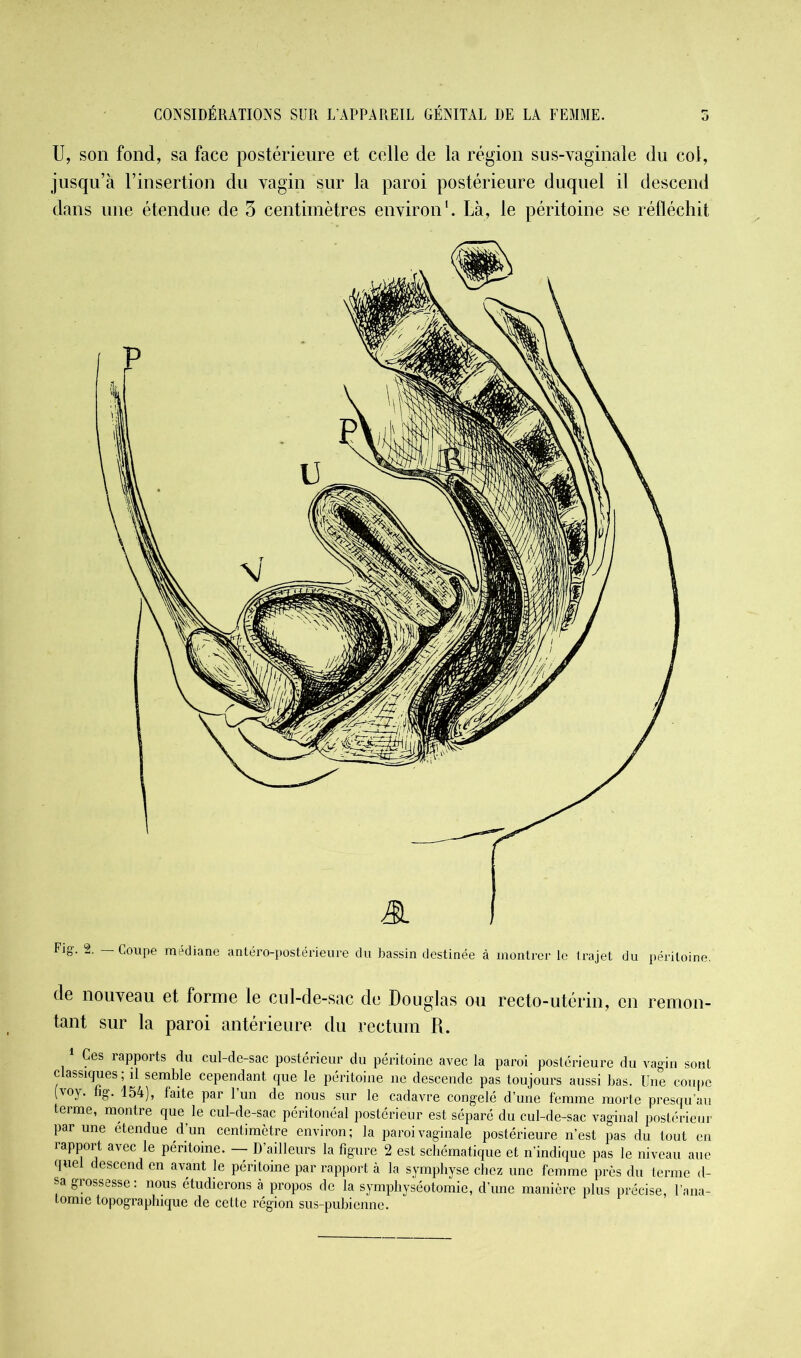 U, son fond, sa face postérieure et celle de la région sus-vaginale du col, jusqu’à l’insertion du vagin sur la paroi postérieure duquel il descend dans une étendue de 3 centimètres environ1. Là, le péritoine se réfléchit de nouveau et forme le cul-de-sac de Douglas ou recto-utérin, en remon- tant sur la paroi antérieure du rectum R. Ces rapports du cul-de-sac postérieur du péritoine avec la paroi postérieure du vagin sont classiques ; il semble cependant que le péritoine ne descende pas toujours aussi bas. Une coupe (voy. fig. 154), faite par Pun de nous sur le cadavre congelé d’une femme morte presqu’au terme, montre que le cul-de-sac péritonéal postérieur est séparé du cul-de-sac vaginal postérieur par une étendue d'un centimètre environ; la paroi vaginale postérieure n’est pas du tout en rapport avec le péritoine. — D’ailleurs la figure 2 est schématique et n’indique pas le niveau aue quel descend en avant le péritoine par rapport à la symphyse chez une femme près du terme d- sa grossesse : nous étudierons à propos de la symphyséotomie, d’une manière plus précise, l'ana- tomie topographique de cette région sus-pubienne.