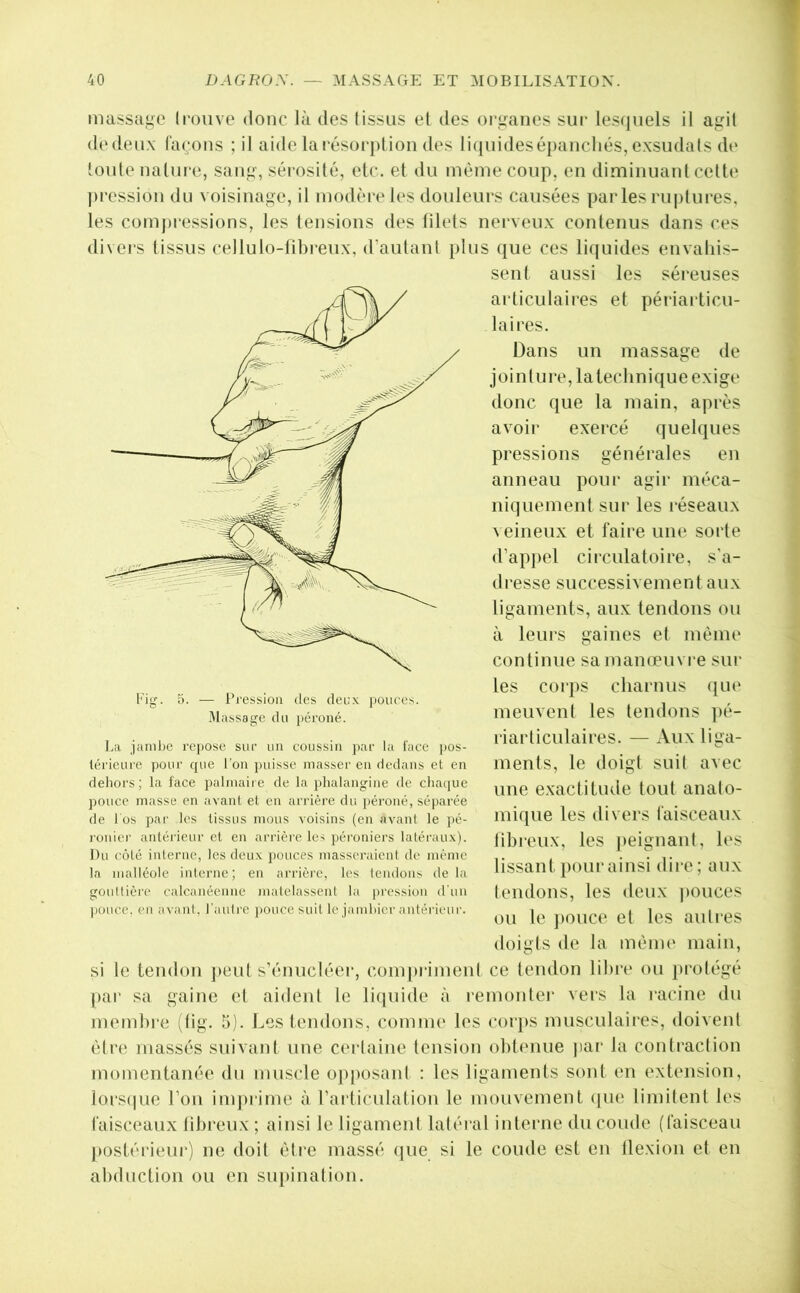 massage ll■ouve donc là des lissas el des organes sur les<juels il agit dedeux (aeons ;il aide larésoi-pLion des ii(piidesépancliés, exsudais de loule nature, sang, sérosité, etc. et du môme coup, en diminuant cette pression du voisinage, il modère les douleurs causées parles ruptures, les compressions, les tensions des tilels nerveux contenus dans ces divers tissus cellulo-tibreux, d’autant plus que ces li(|uides envahis- sent aussi les séreuses articulaires et périailicu- laires. Dans un massage de jointure, la technique exige donc que la main, après avoii’ exercé quelques pressions générales en anneau pour agir méca- niquement sur les l’éseaux veineux et faire une sorte d’appel circulatoire, s’a- dresse successivement aux ligaments, aux tendons ou à leurs gaines et même continue sa manœuvre sur les corps charnus ([ue meuvent les tendons ])é- riarticulaires. — Aux liga- ments, le doigt suit avec une exactitude tout anato- mique les divers faisceaux lihreux, les j)eignant, les lissant pour ainsi dire; aux lendons, les deux i)Ouces ou le ])ouce et les auti‘es doigts de la mênu' main, si le tendon ])eul s’énucléer, com])rimenl ce tendon lihiv ou ])rotégé par sa gaine el aident le liquide à l’emonter vers la racine du memhi-e ;tig. 5). Les lendons, comme les corps musculaires, doivent èlr(‘ massés suivant une cei taine tension ohtenue jiar la contraction momentanée du muscle oj)|)osanl : les ligaments sont en extension, lors(|ue l’on imj)rime à l’aiticulation le mouvement (jinî limitent les faisceaux lihreux ; ainsi le ligament latéral interne du coude (faisceau j)Ostérieur) ne doit être massé (jiie si le coude est en llexion et en ahduction ou en supination. Mgf. O. — Pression des deux pouces. .Alassage du péroné. La jaml)e repose sur un coussin par la l'ace |)OS- térieure pour ejue l’on judsse masser en dedans et en dehors; la lace palmaire de la })halangine de cliatjue pouce masse en avant et en arrière du péroné, séparée de l os pai' les tissus mous voisins (en avant le pé- roniei' antérieur et en arrière les péroniers latéraux). Du côté interne, les deux pouces masseraient de même la malléole interne; en arrière, les tendons delà goullière calcanéenne matelasseid la pression d'un pouce, en avant, l’auli'e pouce suit le jamhier antérieur.