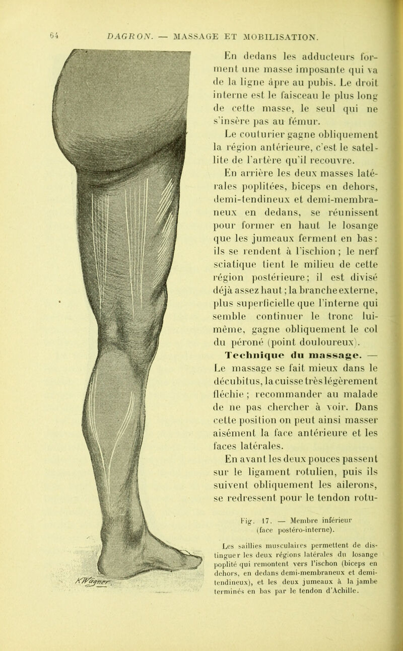 MASSAGE ET MOBILISATION. En dedans les adducteurs for- ment une masse imposante ([ui va de la ligne âpre au pubis. Le droit inteine est le faisceau le plus long de cette masse, le seul qui ne s’insère pas au fémur. Le couturier gagne obliquement la région antérieure, c'est le satel- lite de l’artère qu’il recouvre. En arrière les deux masses laté- lales poplitées, biceps en dehors, demi-tendineux et demi-membra- neux en dedans, se réunissent pour former en haut le losange que les jumeaux ferment en bas; ils se rendent à l'ischion ; le nerf sciatique tient le milieu de cette région postérieure; il est divisé déjà assez haut ; la branche externe, plus superticielle que l’interne qui semble continuer le tronc lui- mème, gagne obliquement le col du péroné (point douloureux). Tecliniquo du massage. — Le massage se fait mieux dans le décubitus, la cuisse très légèrement tléchie ; recommander au malade de ne pas chercher à voir. Dans cette position on peut ainsi masser aisément la face antérieure et les faces latérales. En avant les deux pouces passent sur le ligament rotulien, puis ils suivent ohliquement les ailerons, se redi essent pour le tendon rotu- Fisj. 17. — Membre inférieur C* (face j)ostéro-interne). Les saillies nuisculaiies permettent de dis- tinguer les deux régions latérales du losange ])oplité qui remontent vers l’ischon (biceps en dehors, en dedans demi-membraneux et demi- tendineux), et les deux jumeaux à la jambe terminés en bas par le tendon d’Achille.